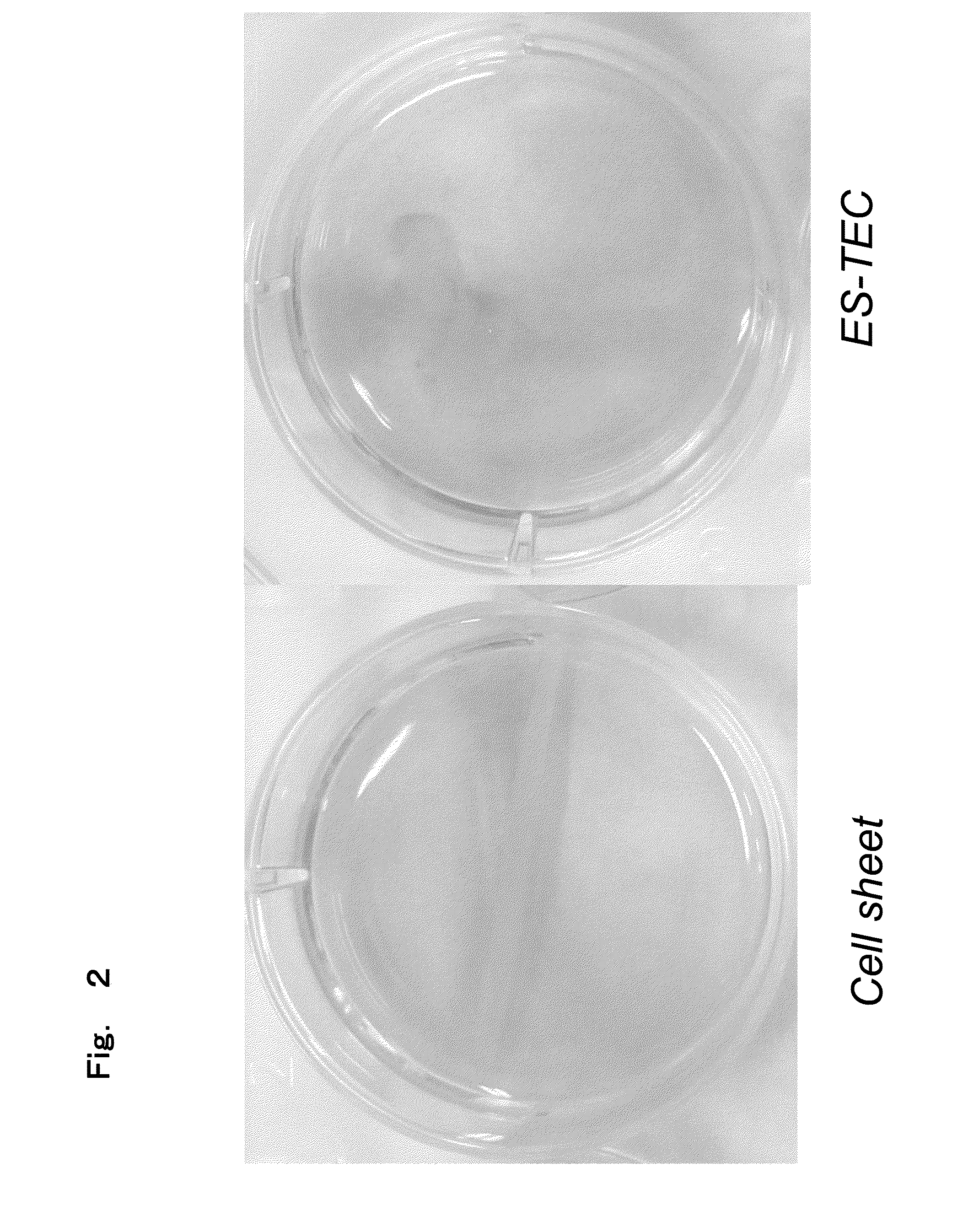 Creation of three-dimensional synthetic tissue from pluripotent stem cell-derived cells, and osteochondral regeneration treatment using said synthetic tissue