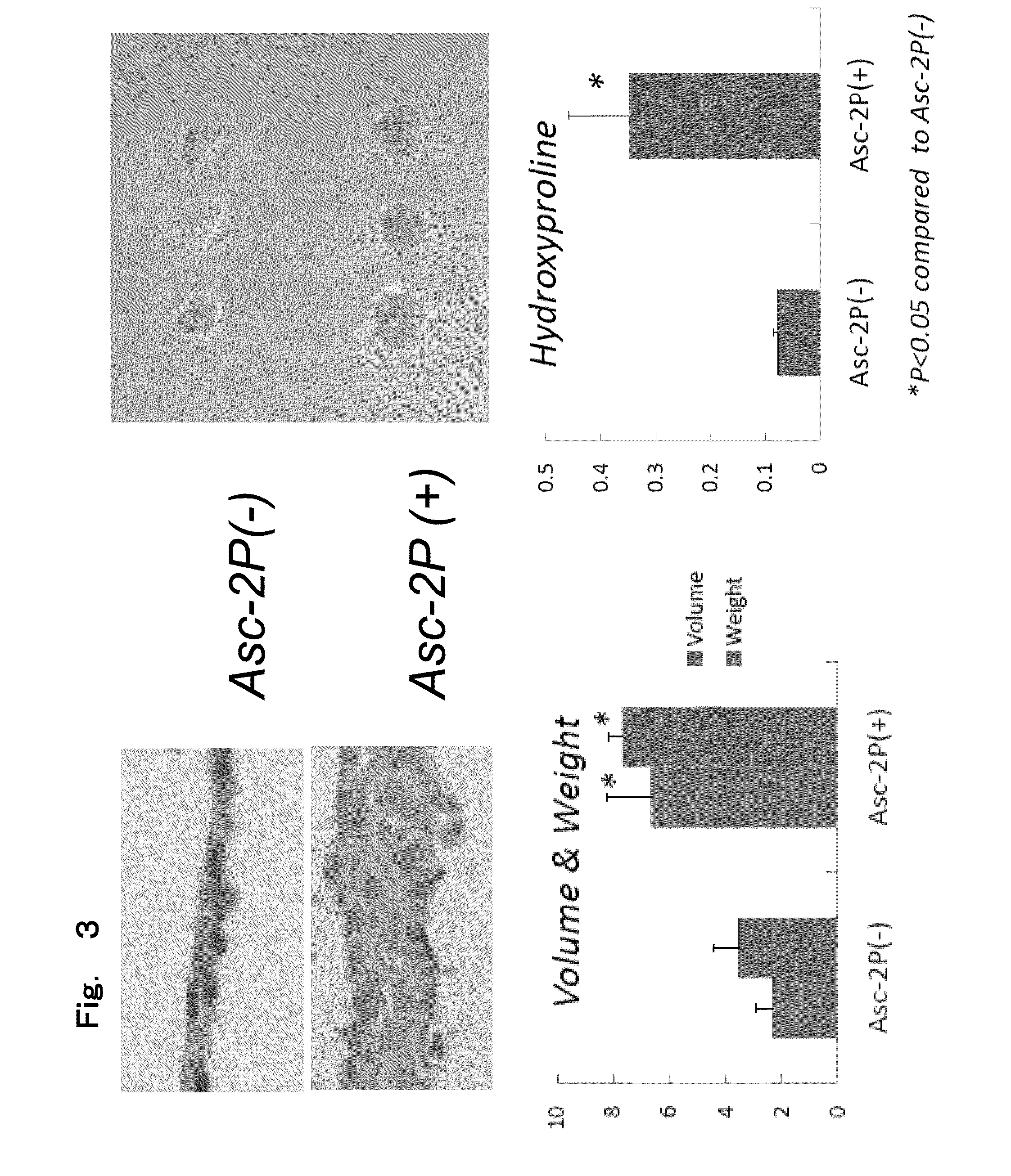 Creation of three-dimensional synthetic tissue from pluripotent stem cell-derived cells, and osteochondral regeneration treatment using said synthetic tissue