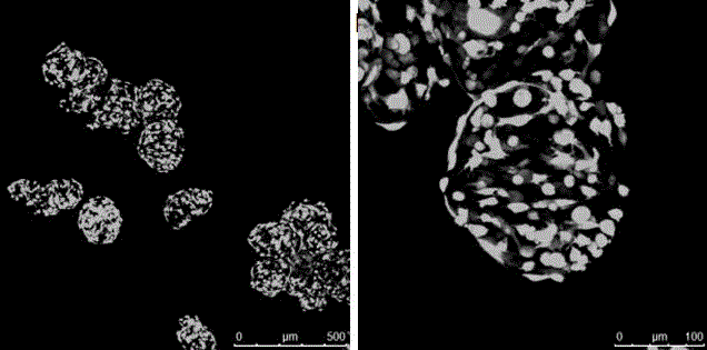 Cell-gel material composite microsphere as well as preparation method and application thereof