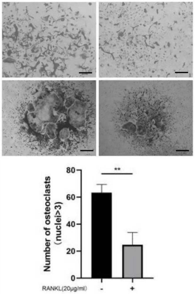 Application of ceramide combined osteoclast surface CD300lf receptor in preparation of medicine for treating periodontitis