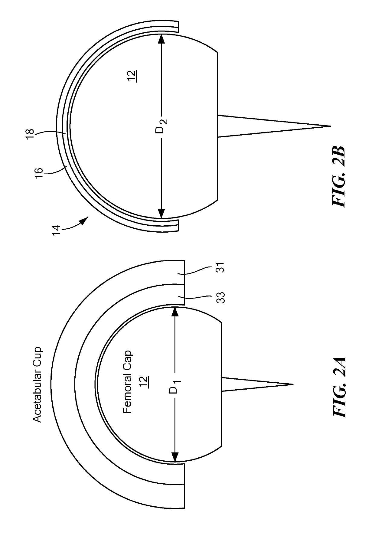 Veterinary hip resurfacing prosthetic system