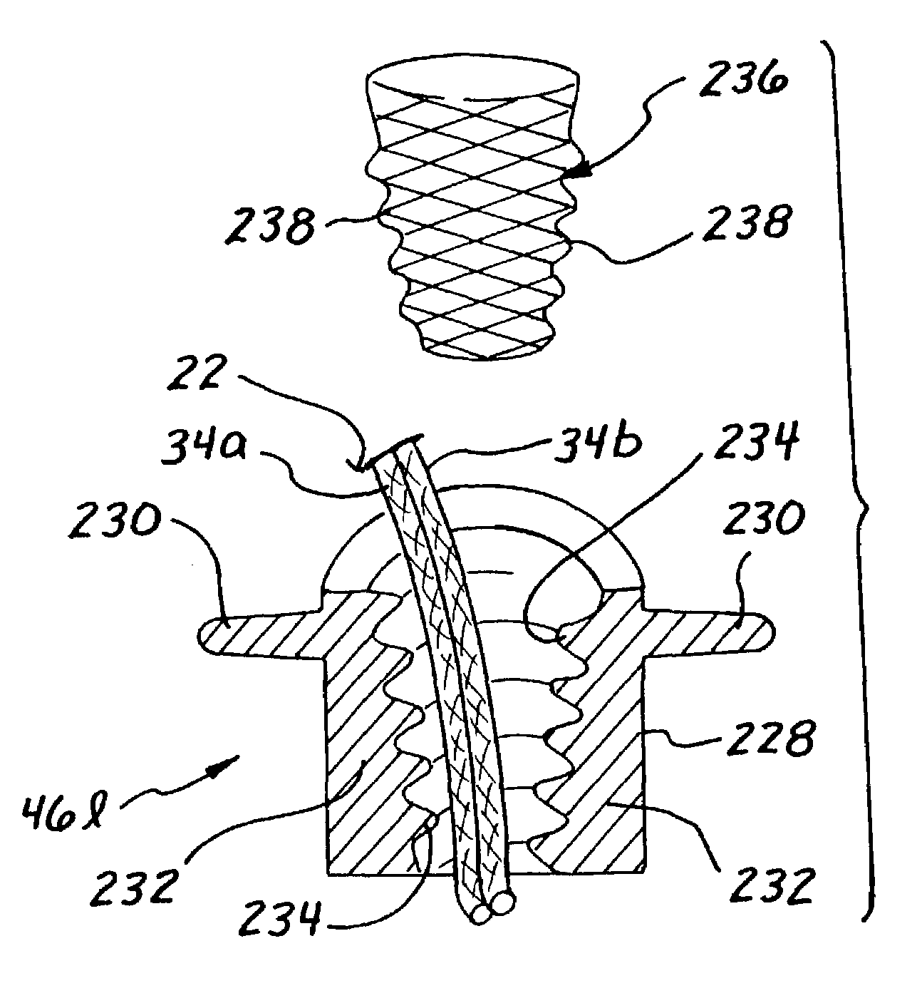 Devices and methods for repairing soft tissue