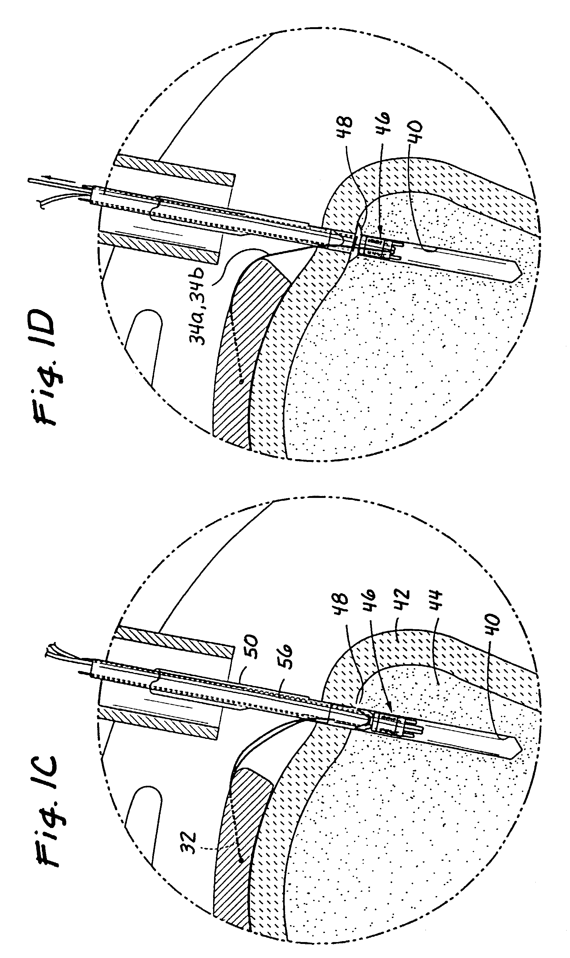 Devices and methods for repairing soft tissue