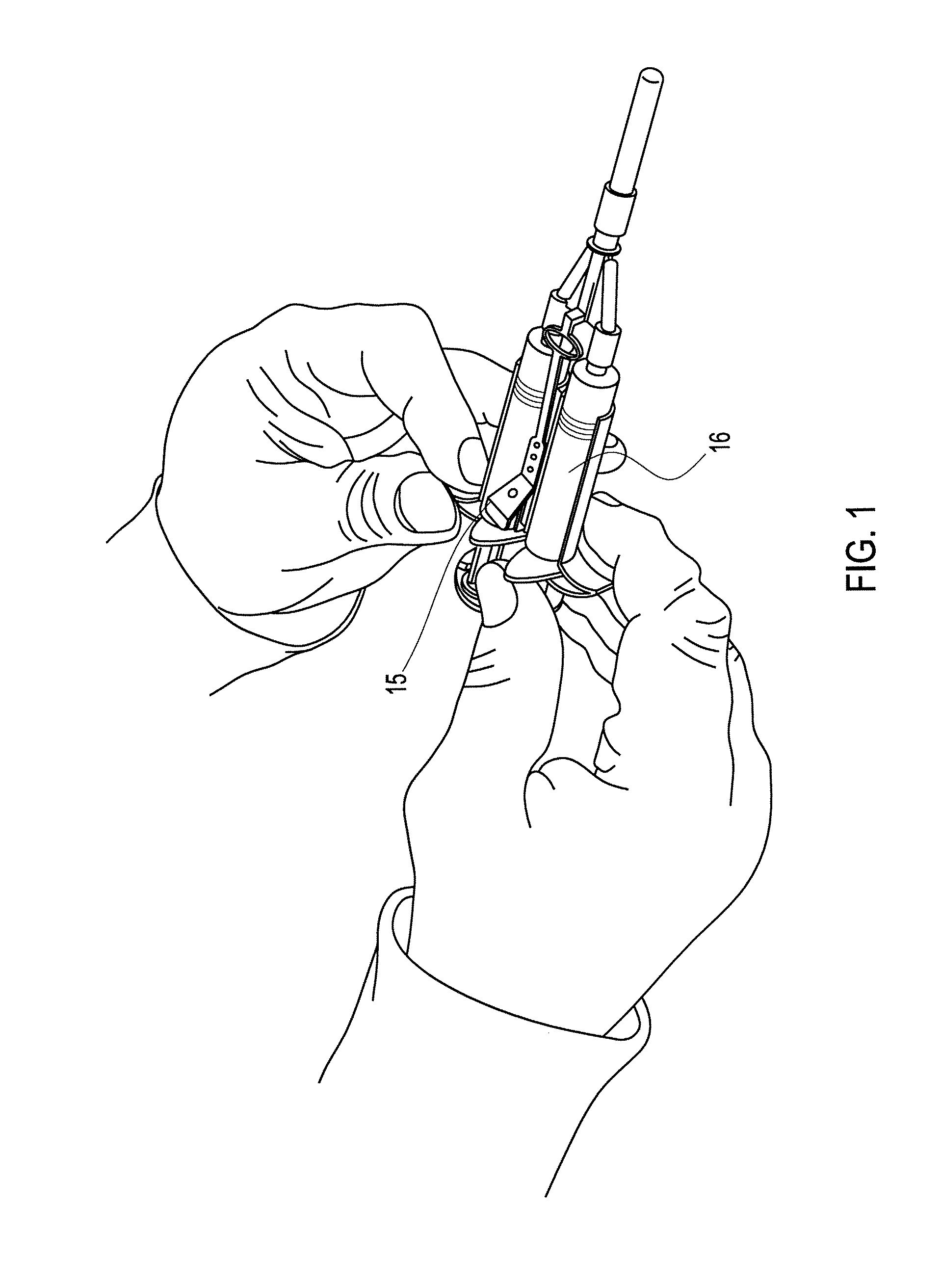 Method of arthroscopic osteochondral resurfacing using prp strengthened with fibrin glue