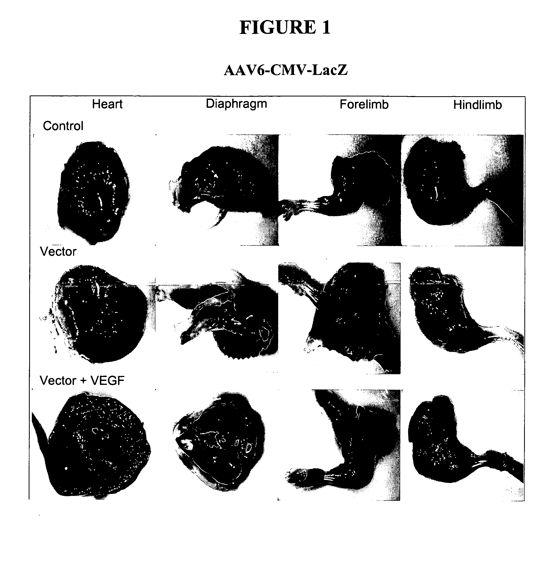 Compositions and methods for systemic nucleic acid sequence delivery