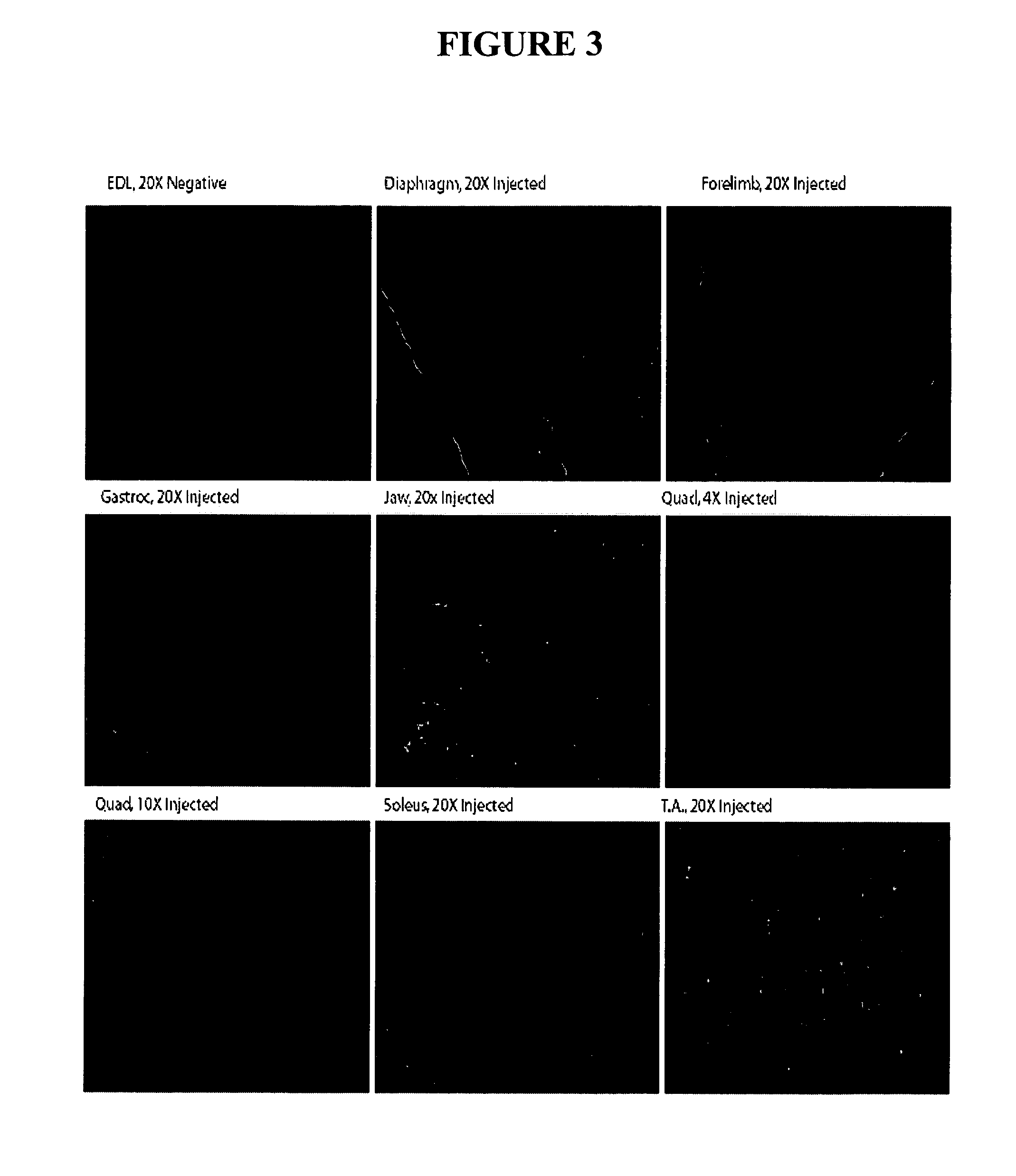 Compositions and methods for systemic nucleic acid sequence delivery