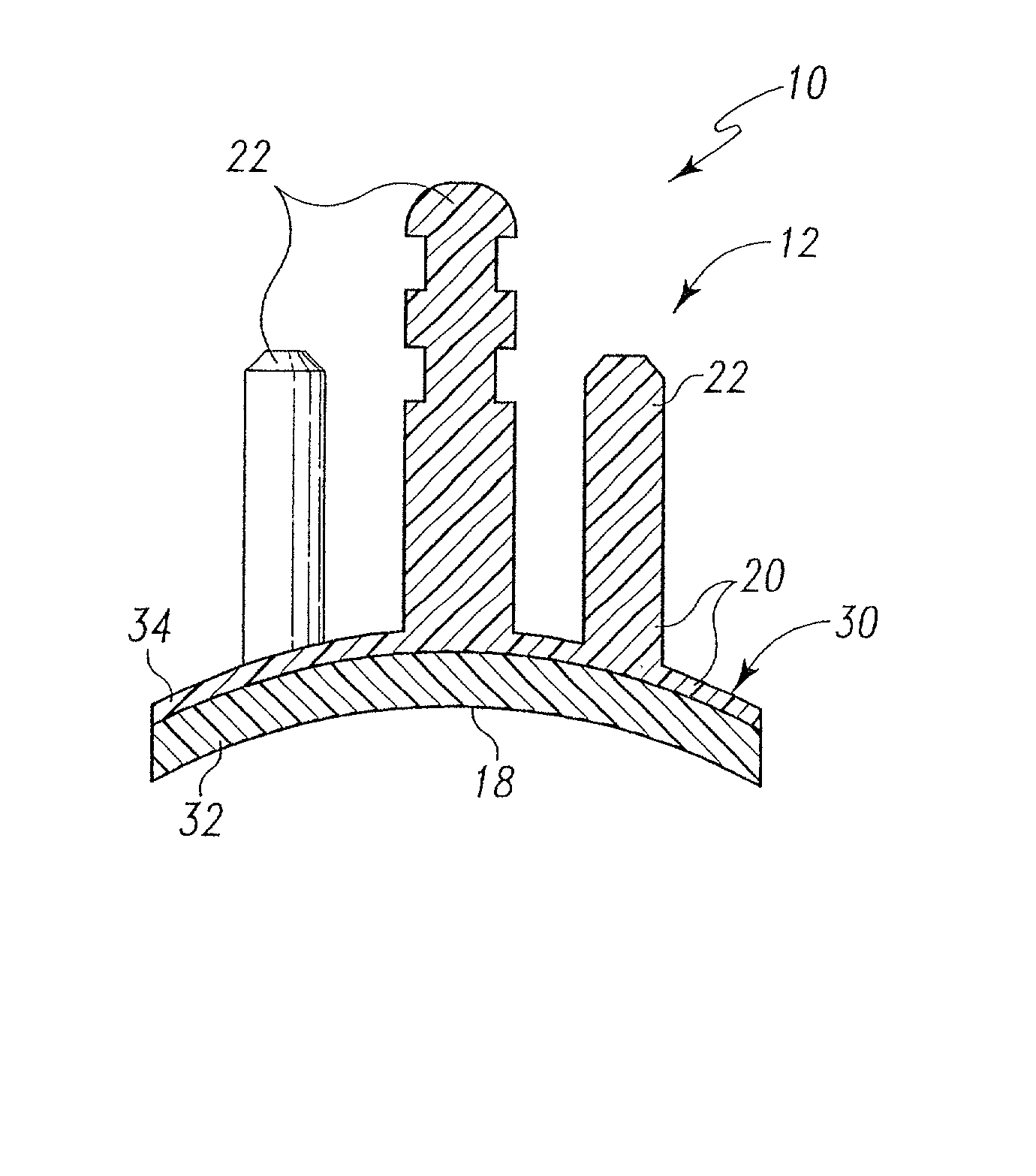 Composite prosthetic bearing constructed of polyethylene and an ethylene-acrylate copolymer and method for making the same