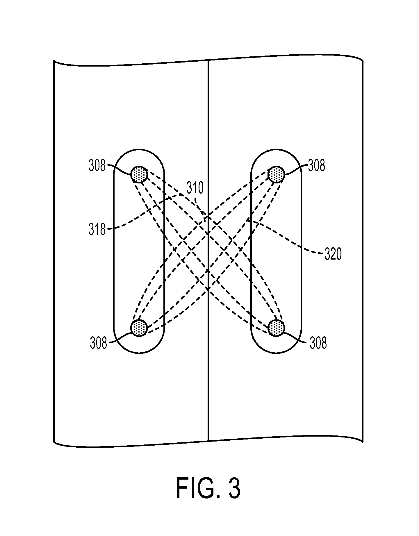 Spinal Cord Stimulation with Interferential Current