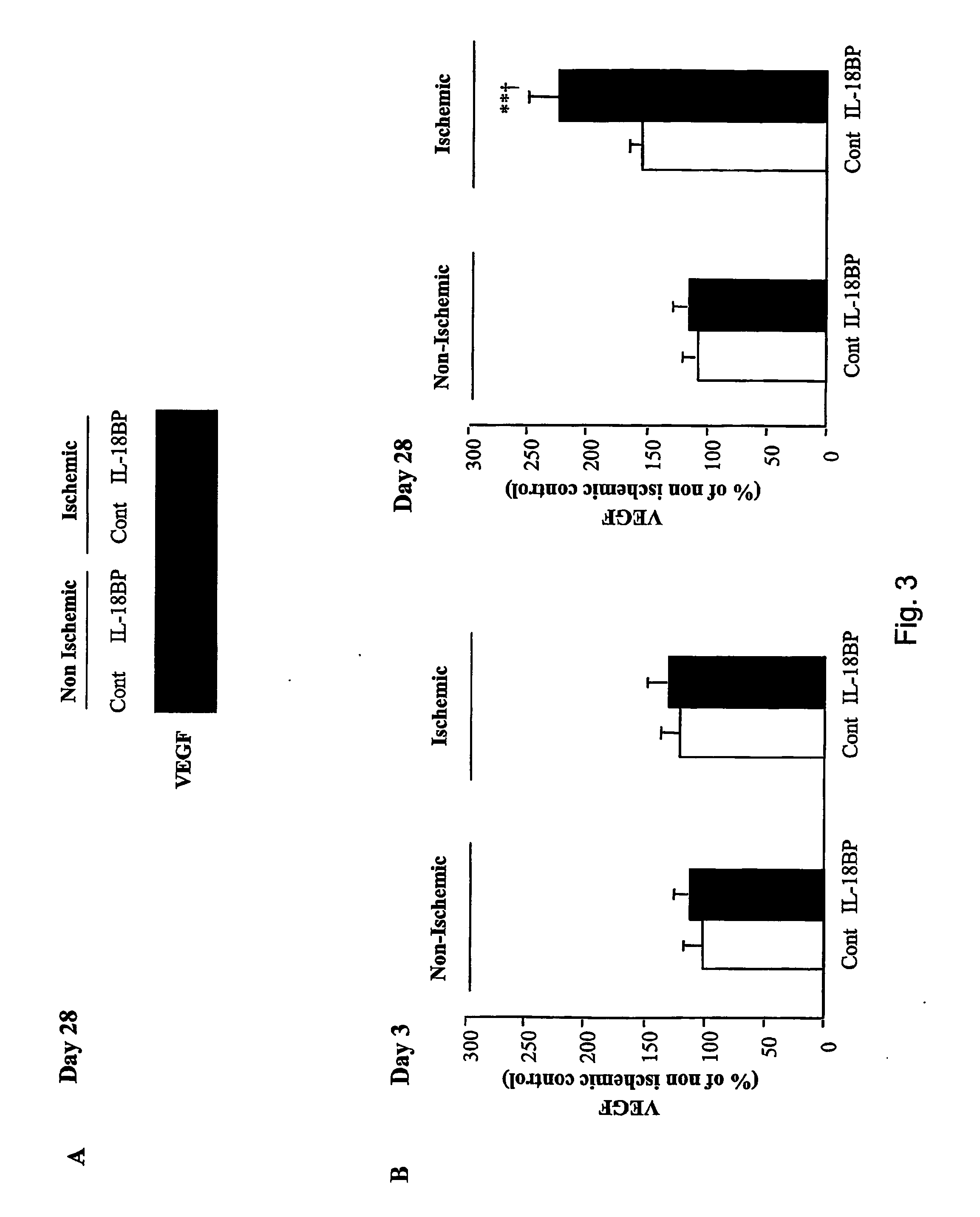 Use of il-18 inhibitors for treatment and/or prevention of peripheral vascular diseases