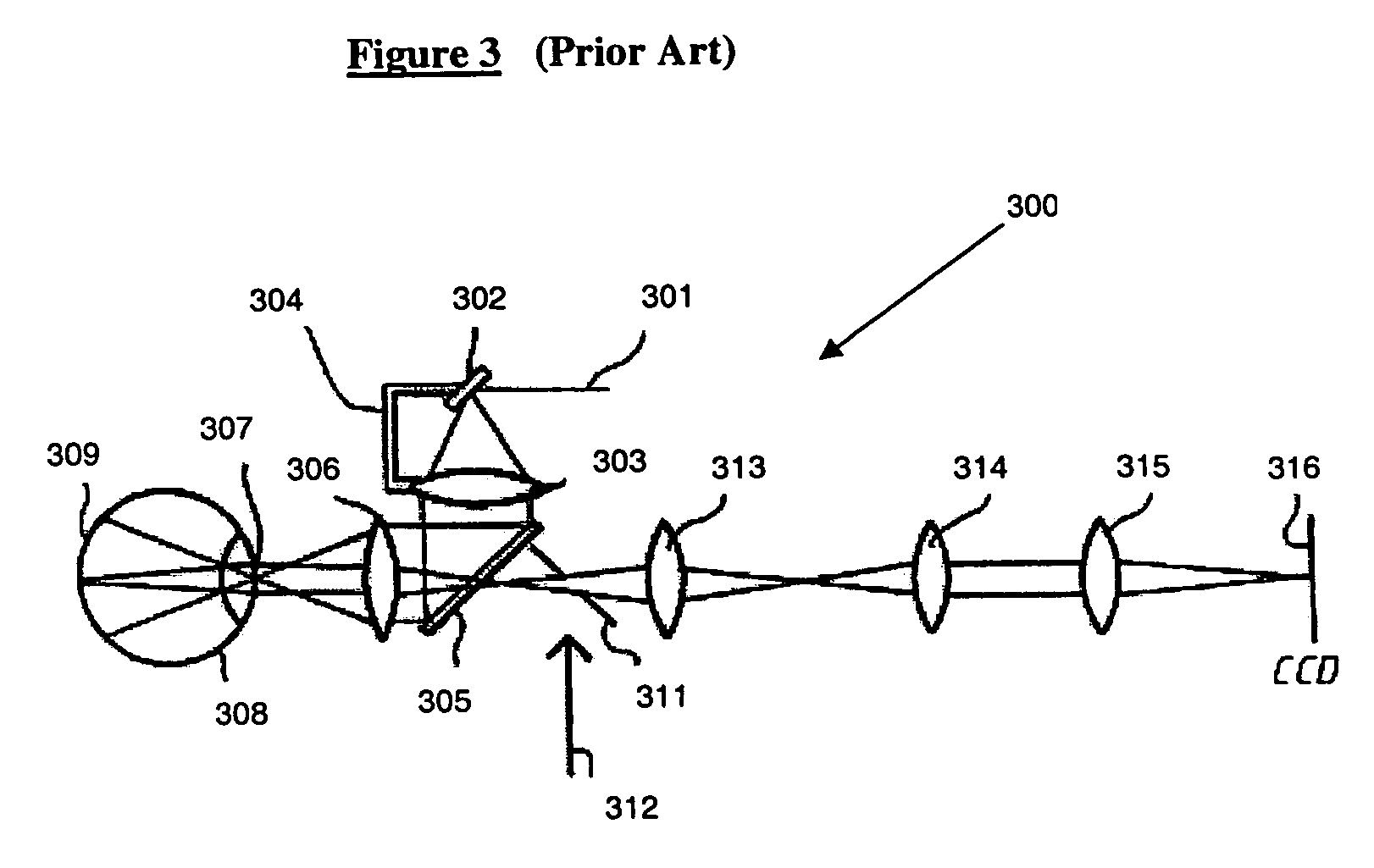 Optical apparatus and method for comprehensive eye diagnosis