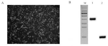 Method for determining titer of a swine transmissible gastroenteritis virus N protein antibody