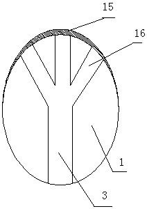 Gynecological curettage device