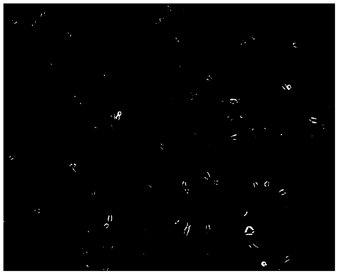 Application of endothelial progenitor cells in transplantation treatment of coronary microembolization of mouse