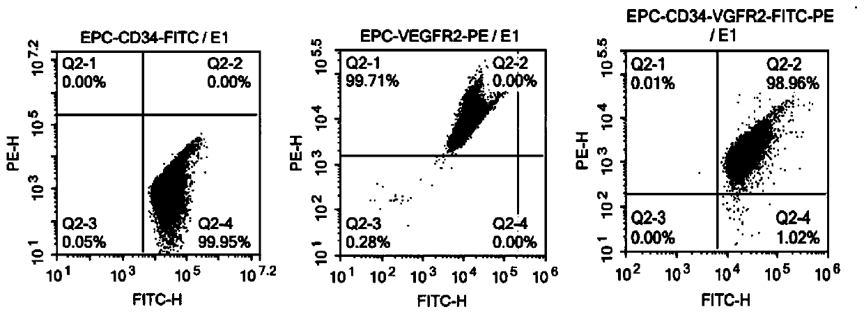 Application of endothelial progenitor cells in transplantation treatment of coronary microembolization of mouse