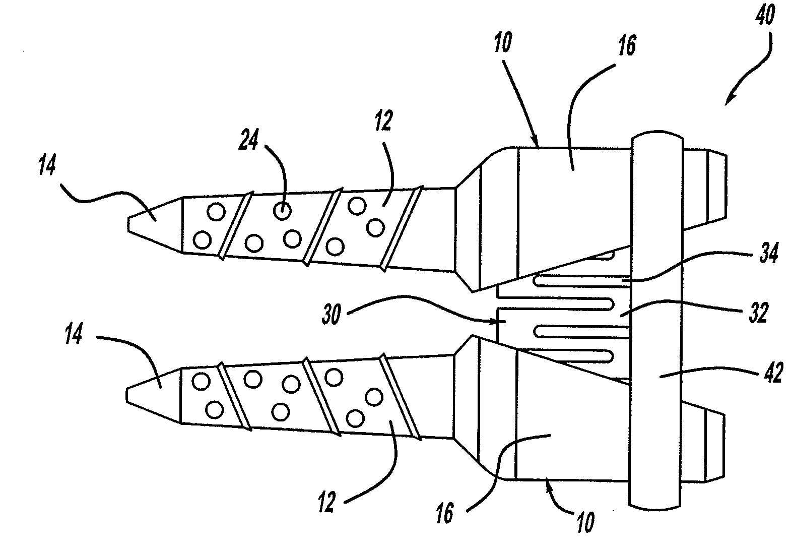 Method for Vertebral Disc Annular Fibrosis Tensioning and Lengthening