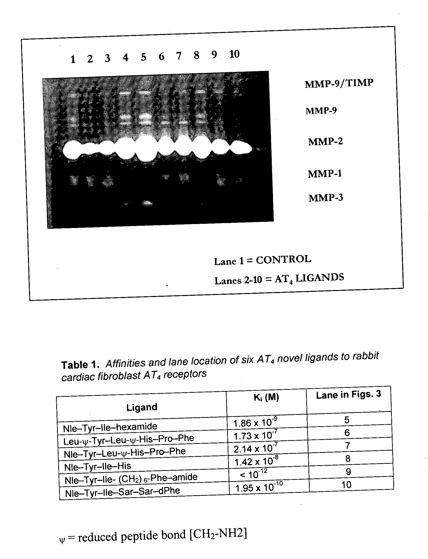 At4 receptor ligands as angiogenic, Anti-angiogenic, and Anti-tumor agents