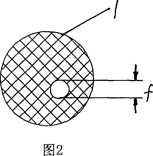 Bracket of vitreous body cavity for curing retina disease, and manufacturing method