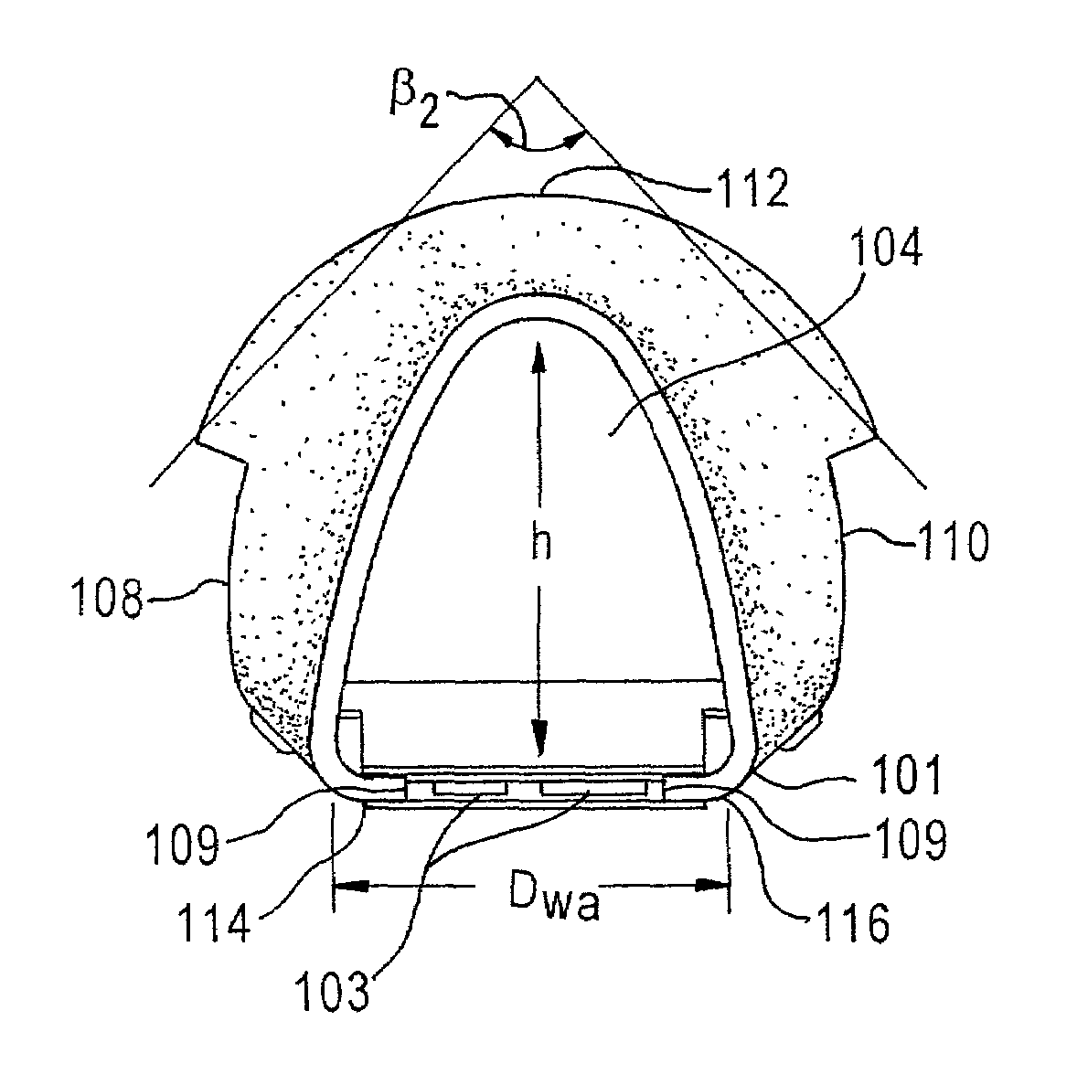 Universal modular glottiscope system having intra-wall channels for vocal fold microsurgery or orotracheal intubation