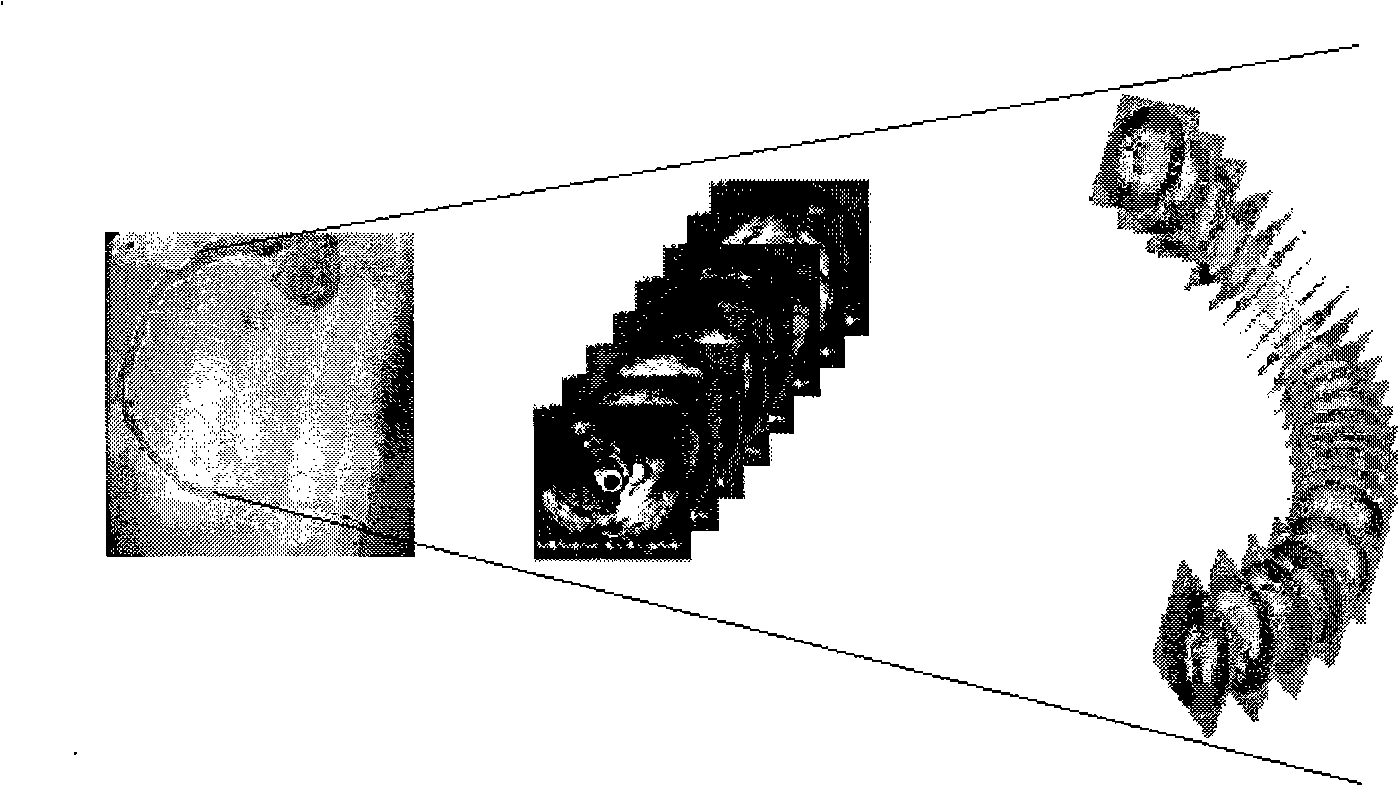 Rebuilding method of blood vessel three-dimensional model