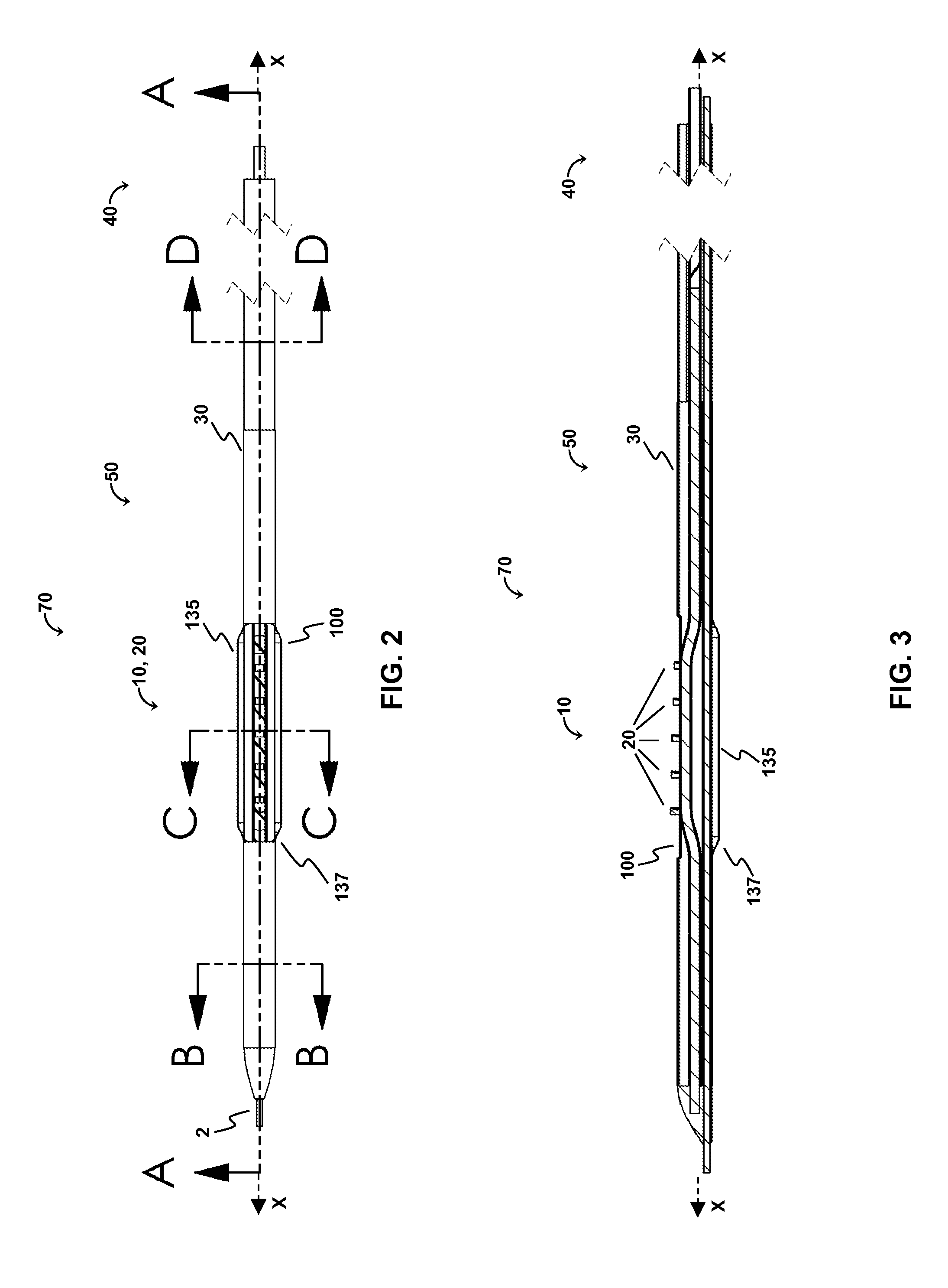 Atherectomy device