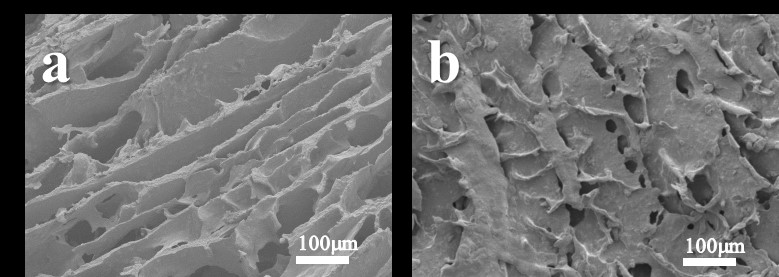 Gel electrolyte of zinc-based battery and preparation and application thereof