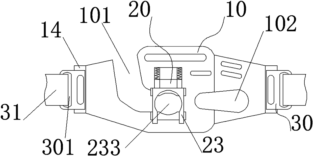 Tracheal intubation fixing apparatus for anesthesia departments