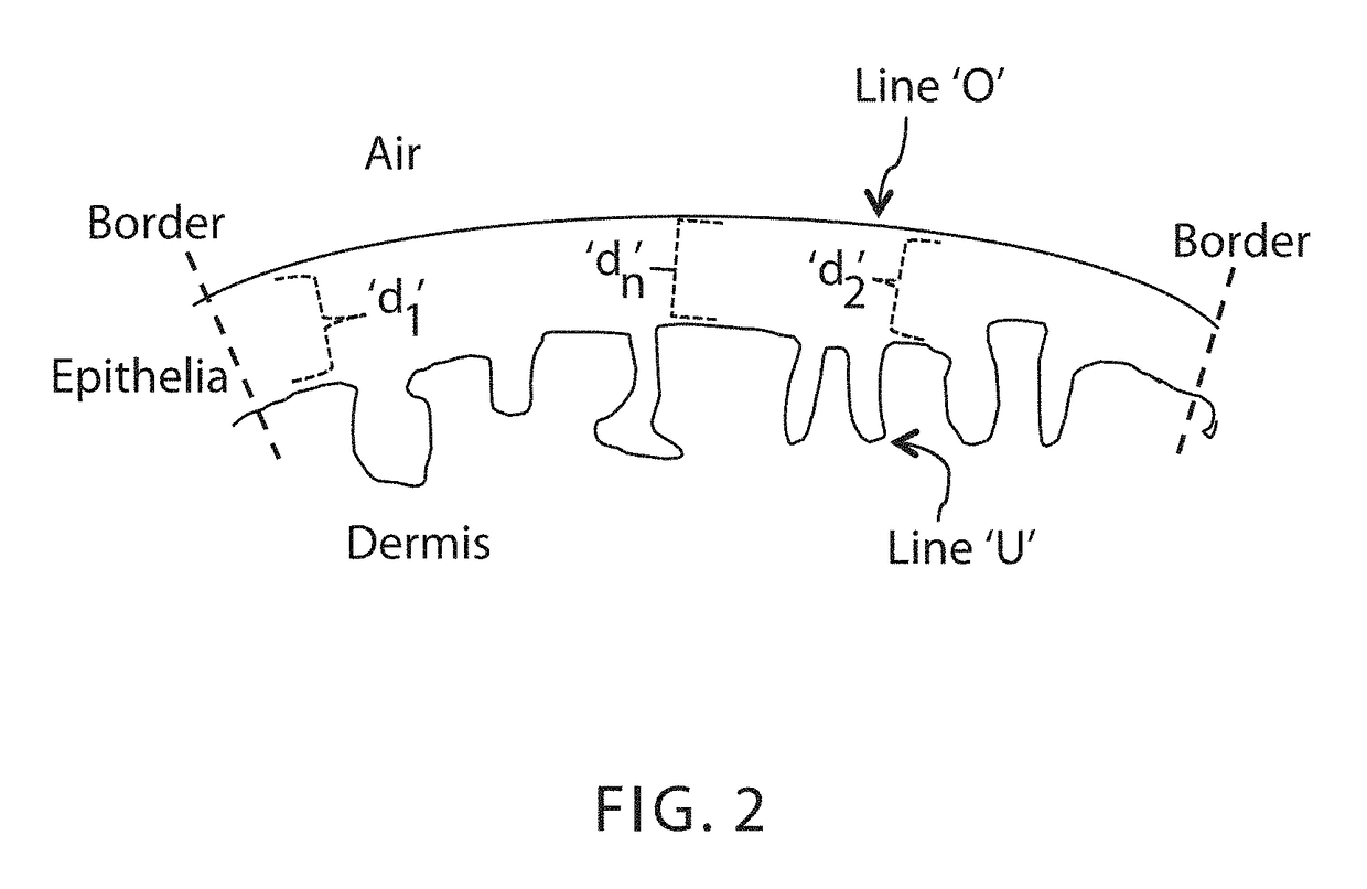 Methods for assessing vaginal atrophy