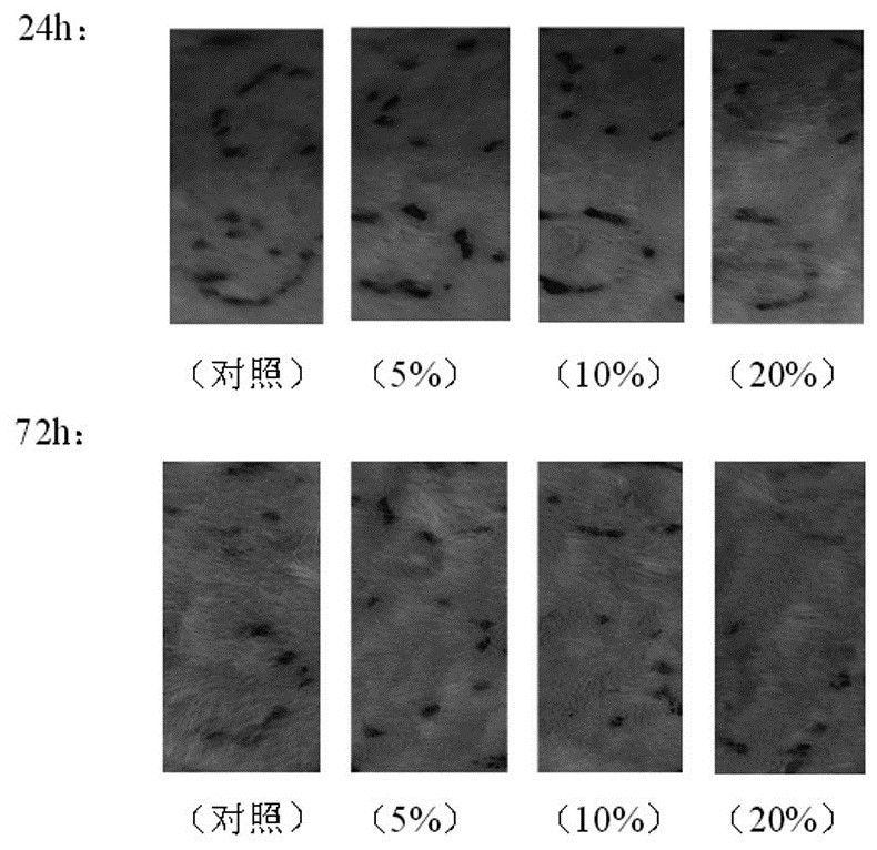 Preparation method of starch microsphere and human recombinant tissue factor lipid composite hemostatic material