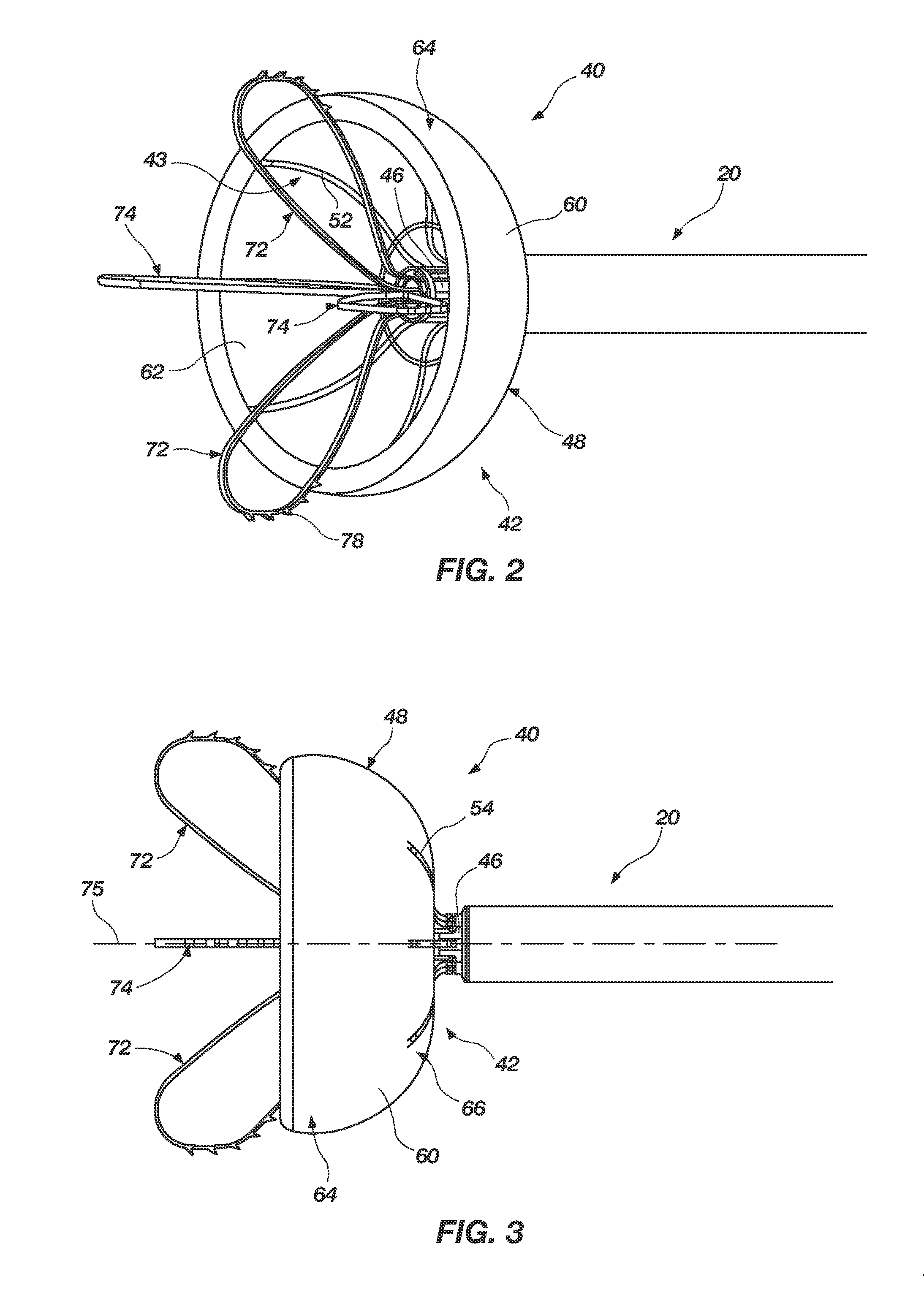 Medical device for modification of left atrial appendage and related systems and methods