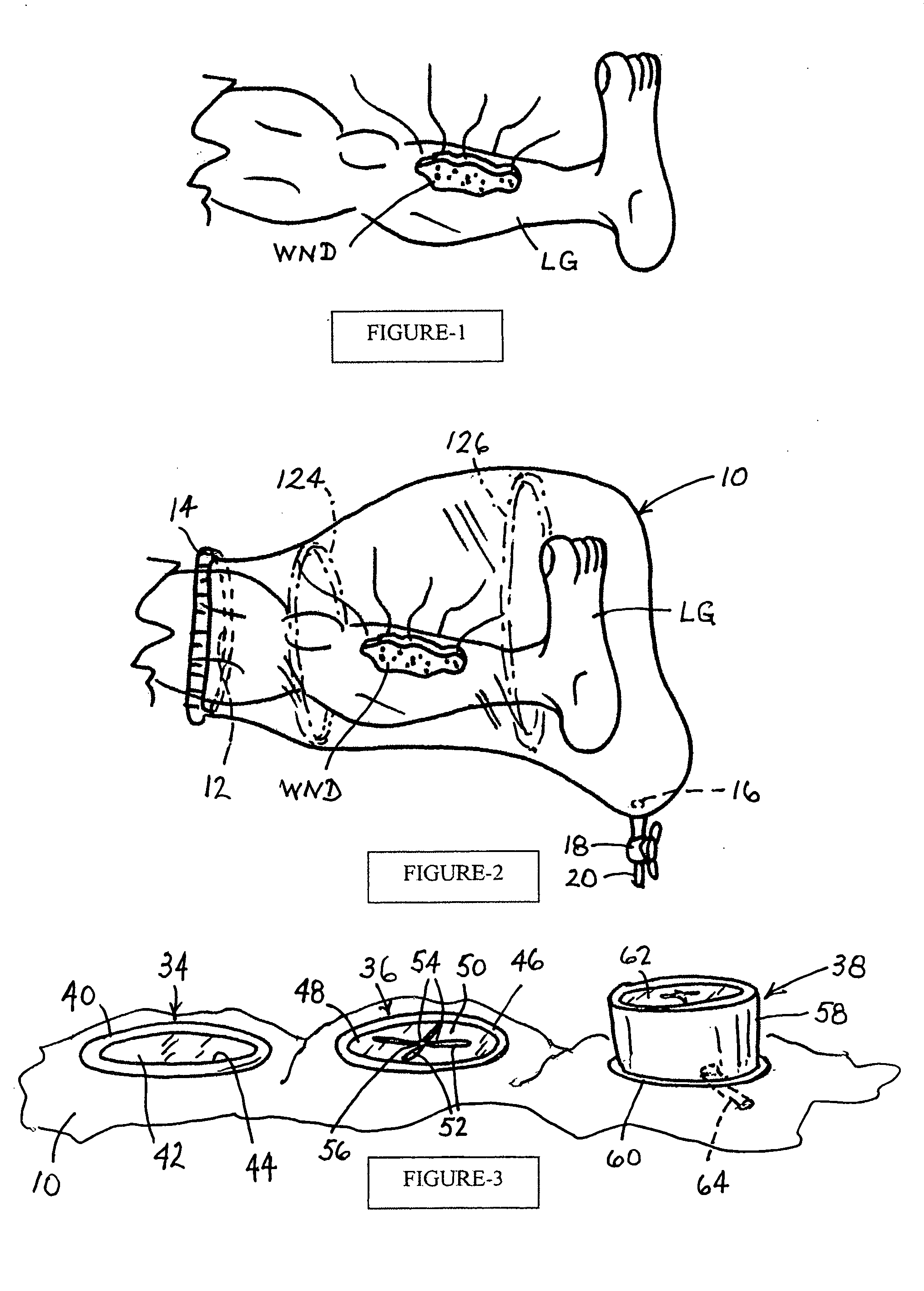 Fluid containment apparatus for surgery and method of use