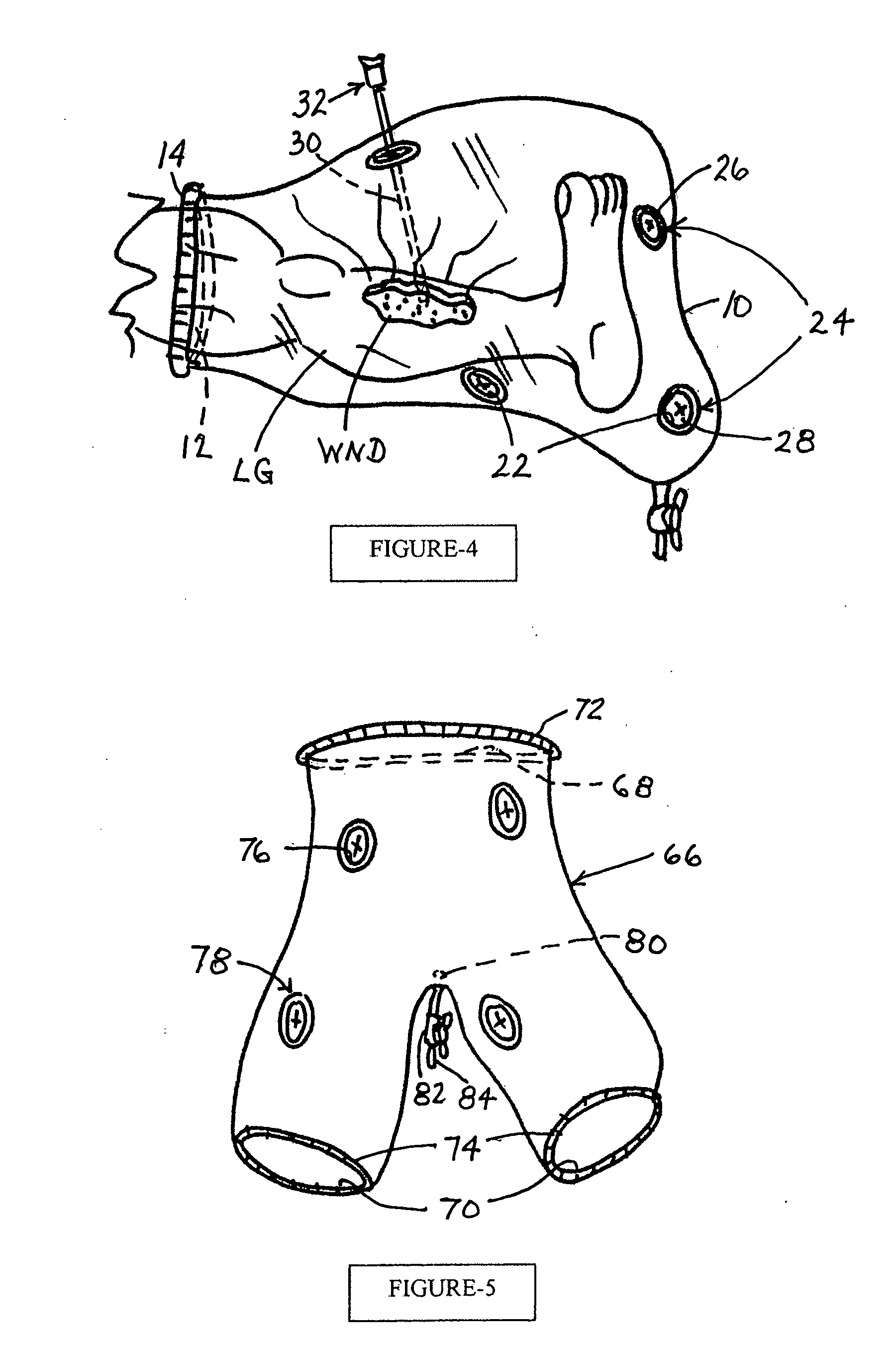 Fluid containment apparatus for surgery and method of use