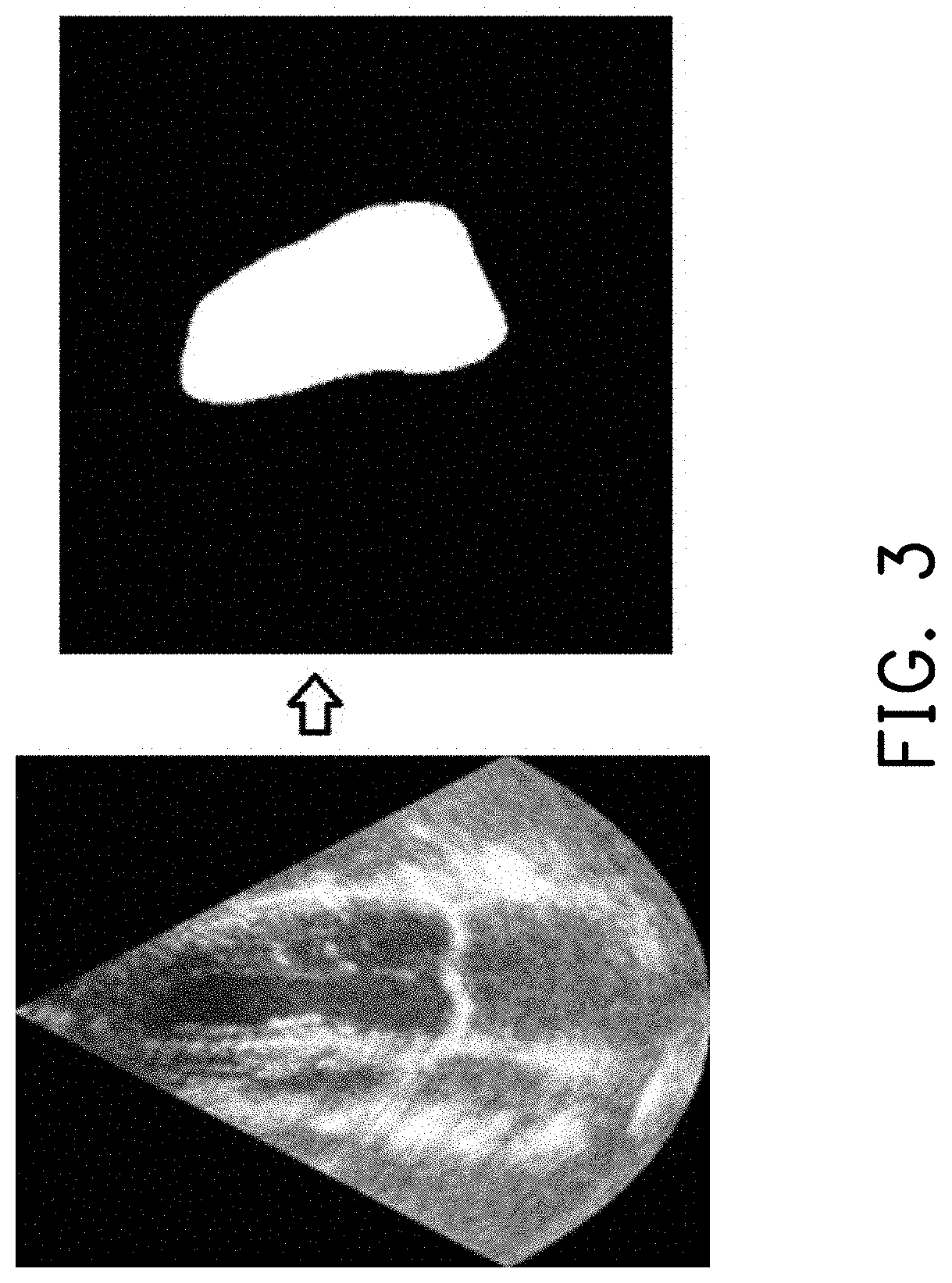 Image processing apparatus for evaluating cardiac images and ventricular status identification method