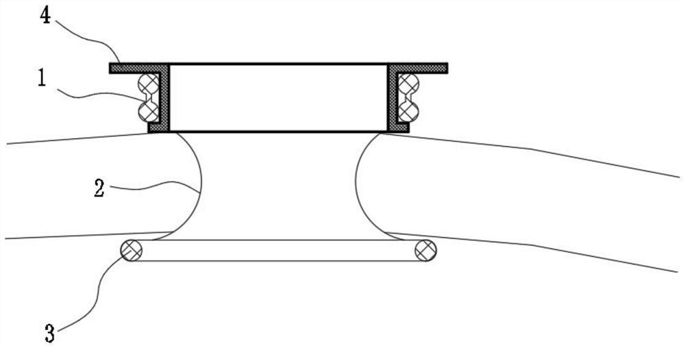 Multifunctional retraction fixator