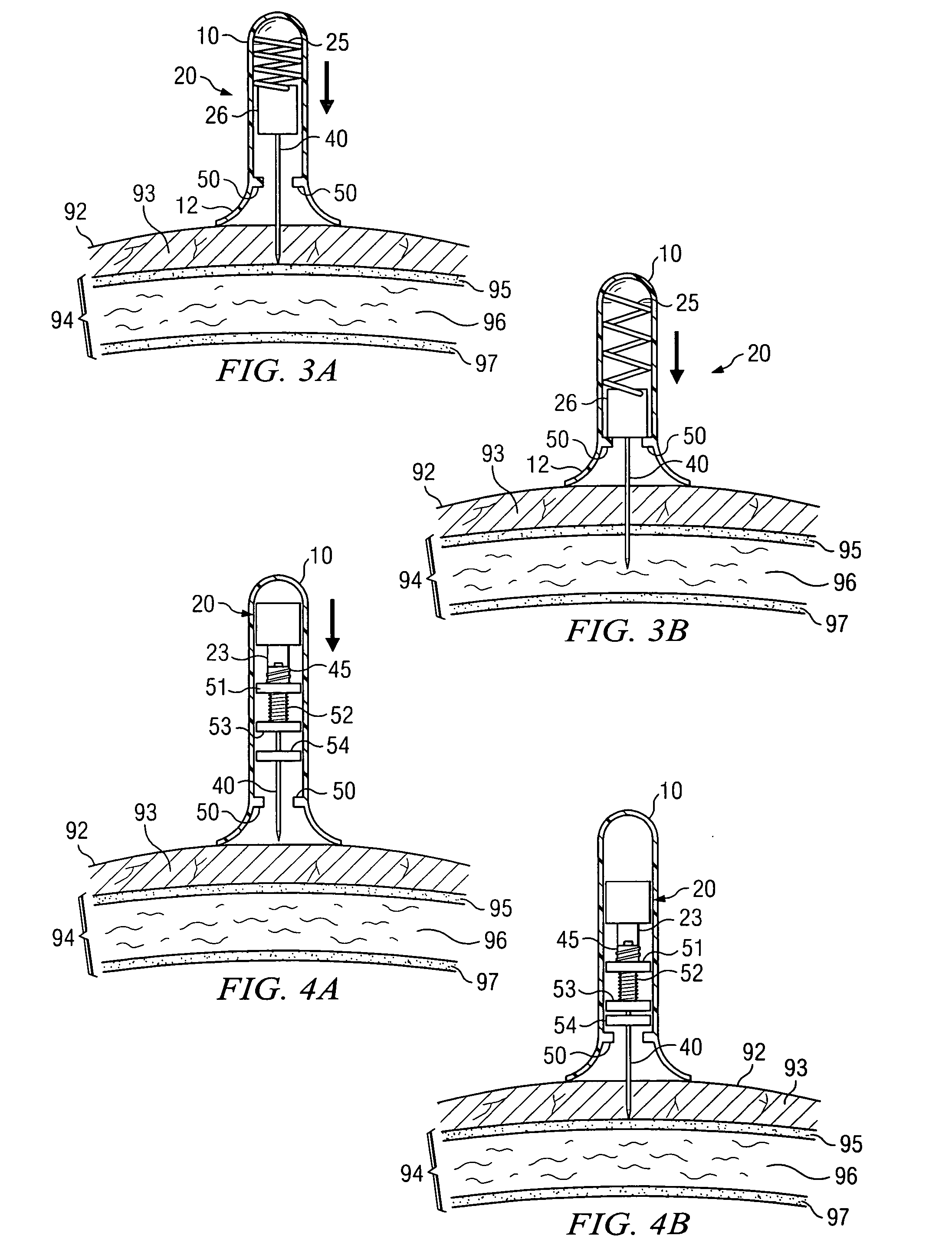 Apparatus and method for accessing the bone marrow