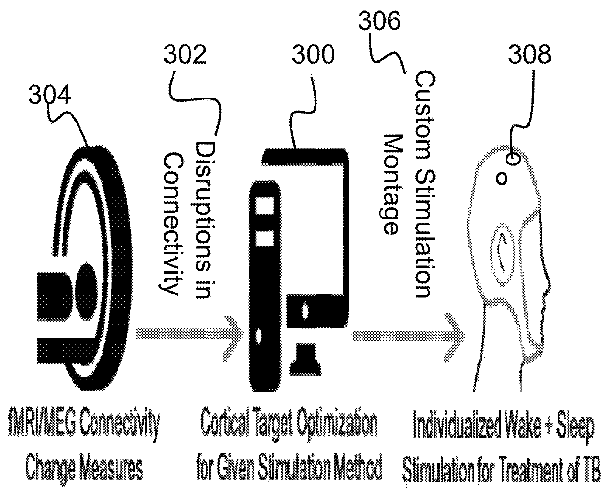 Transcranial stimulation system and method to improve cognitive function after traumatic brain injury