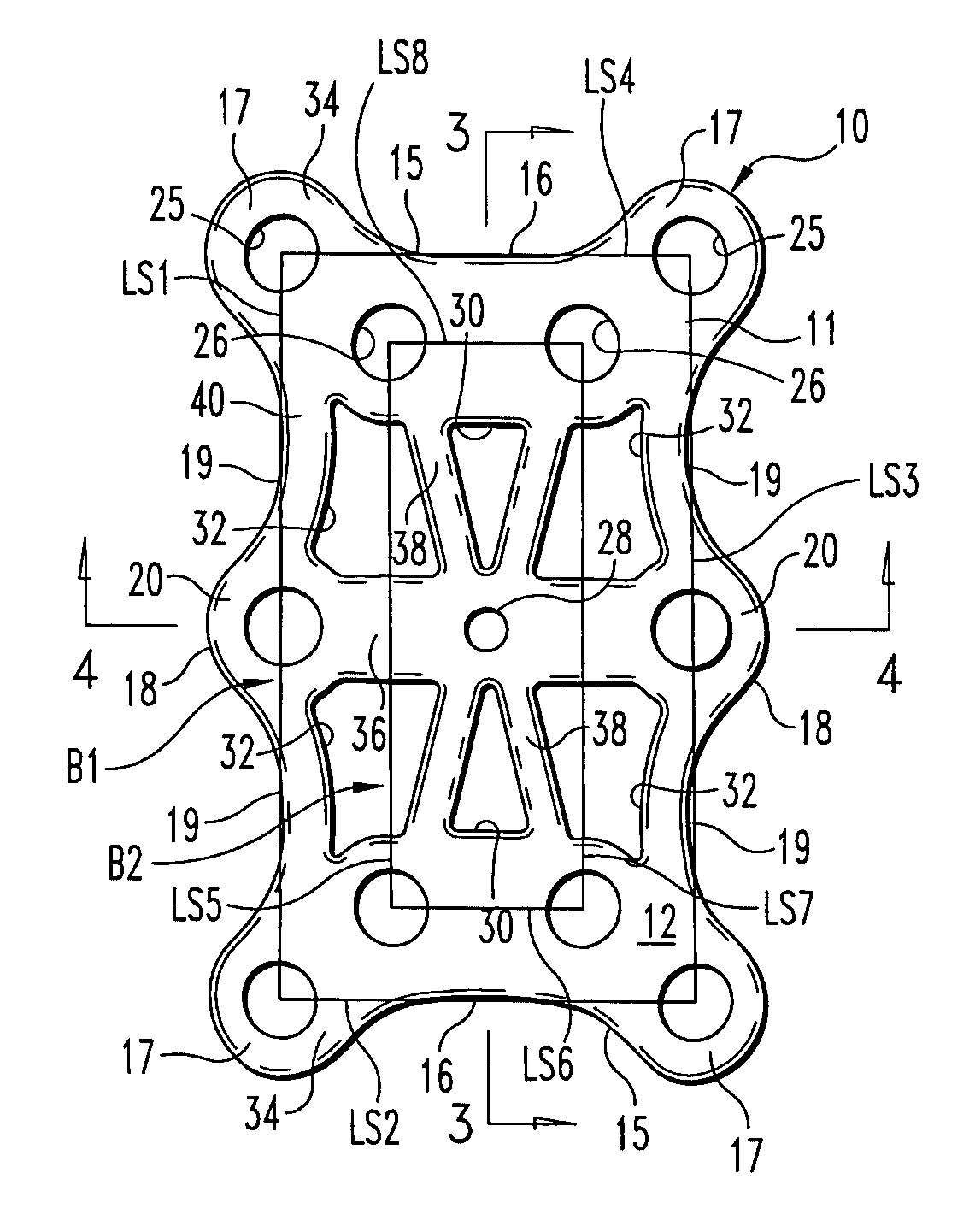 Mid-foot fixation plate