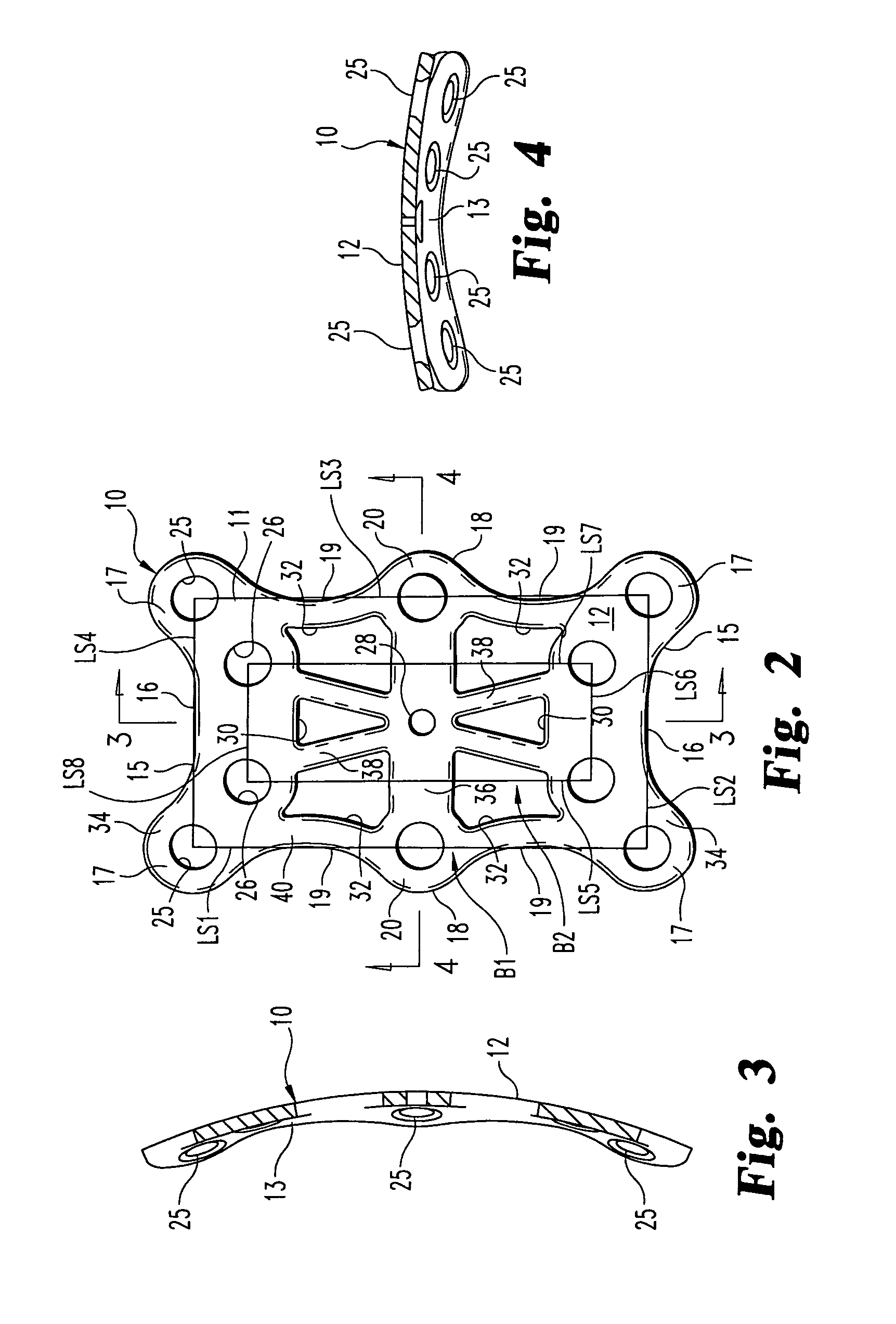 Mid-foot fixation plate