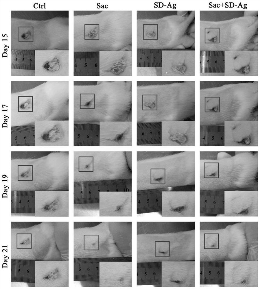 Application of aphanothece sacrum polysaccharide in preparation of medicine for treating scalds