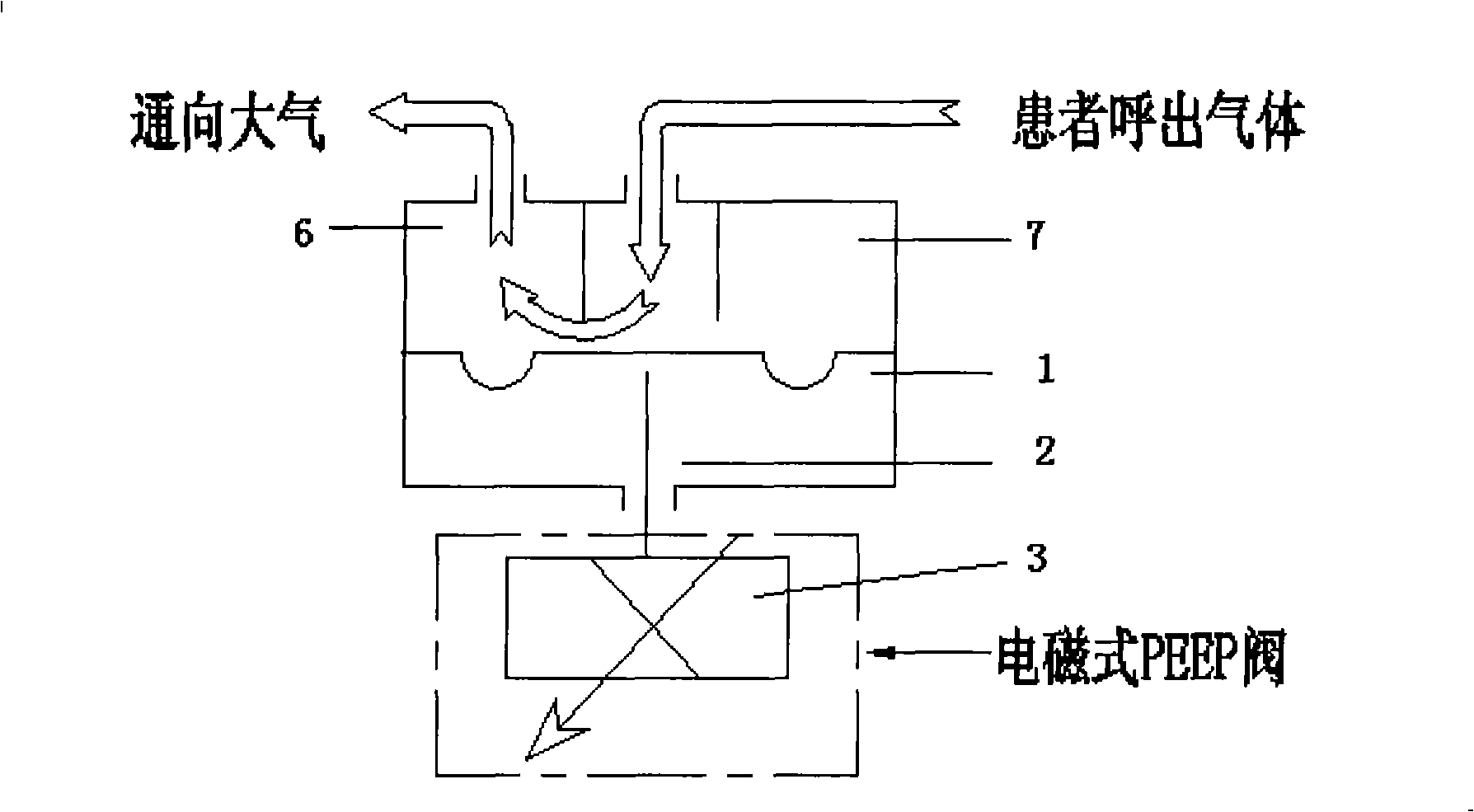 Device and method for controlling expiratory valve