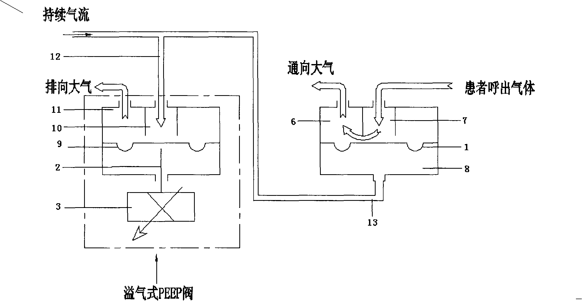 Device and method for controlling expiratory valve