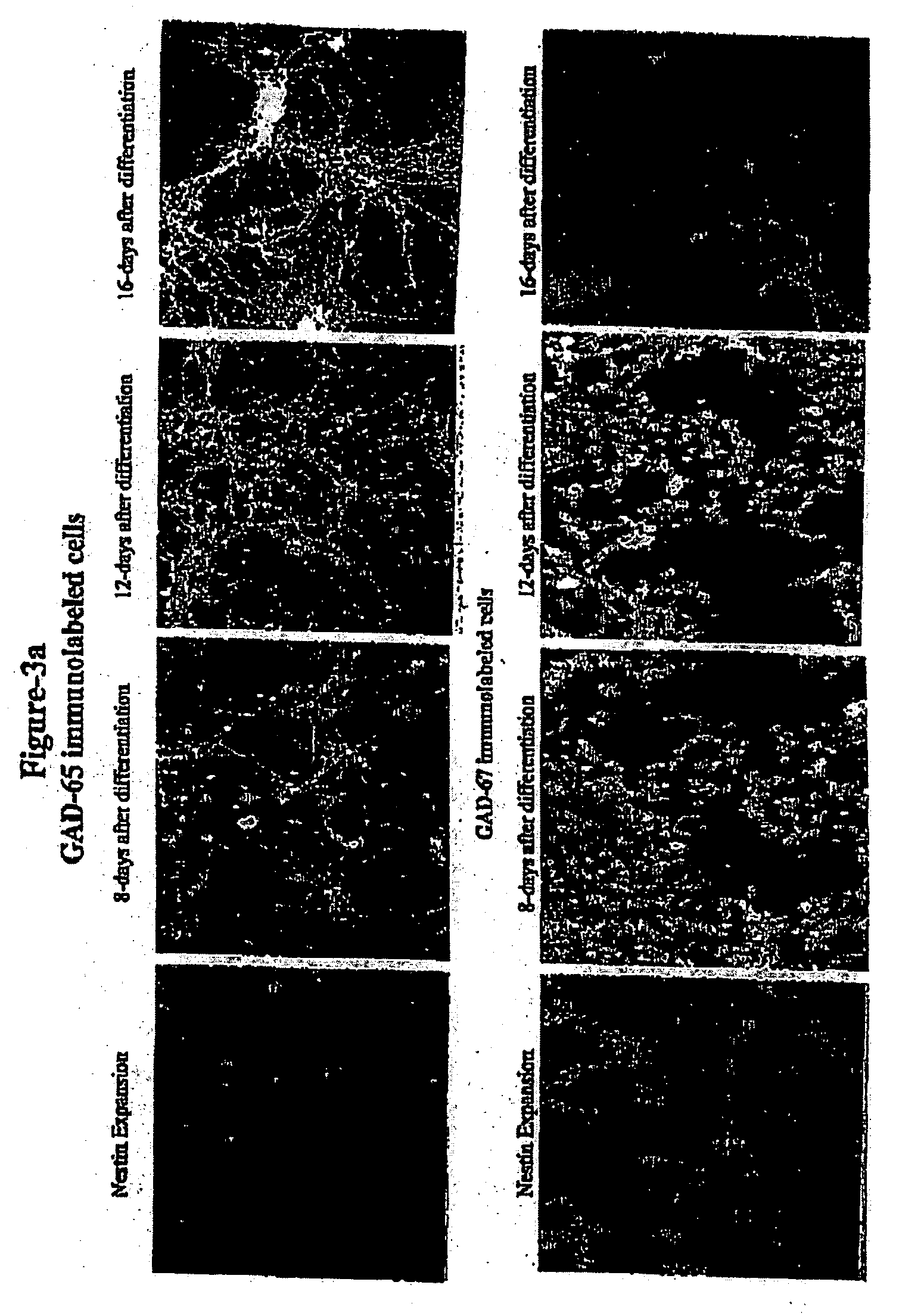 In vitro generation of GABAergic neurons from embryonic stem cells and their use in the treatment of neurological disorders