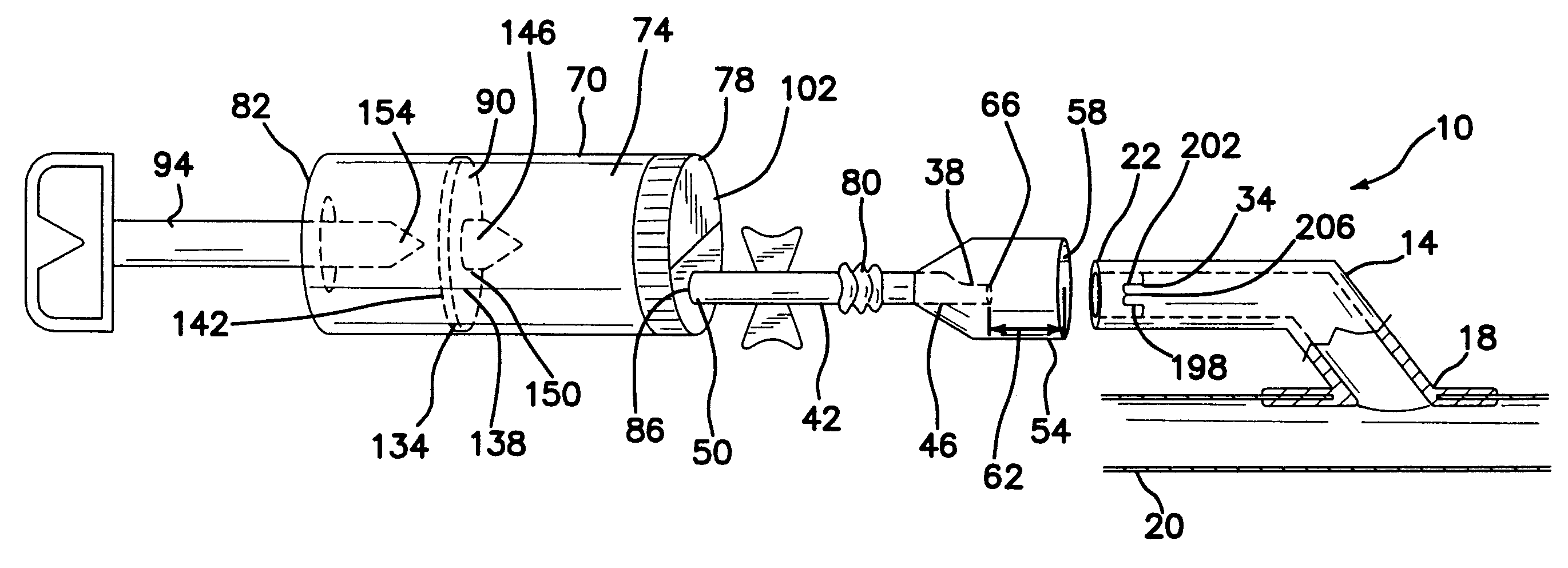 Closed specimen collection system