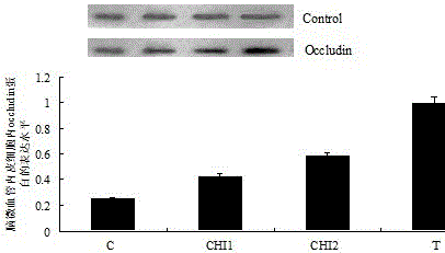 Traditional Chinese medicine preparation for preventing and treating brain metastasis from lung cancer with syndrome of phlegm and static blood blocking orifices and preparation method thereof