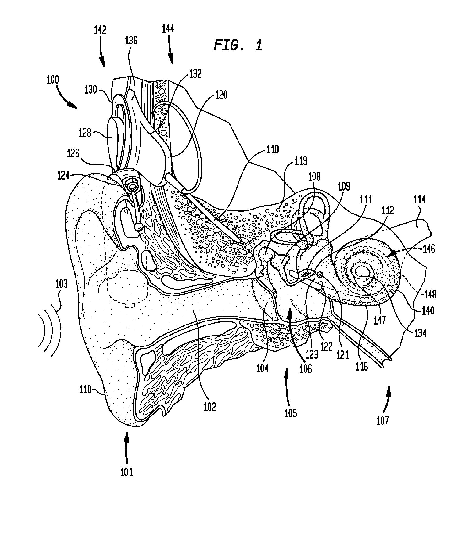 Combined optical and electrical neural stimulation