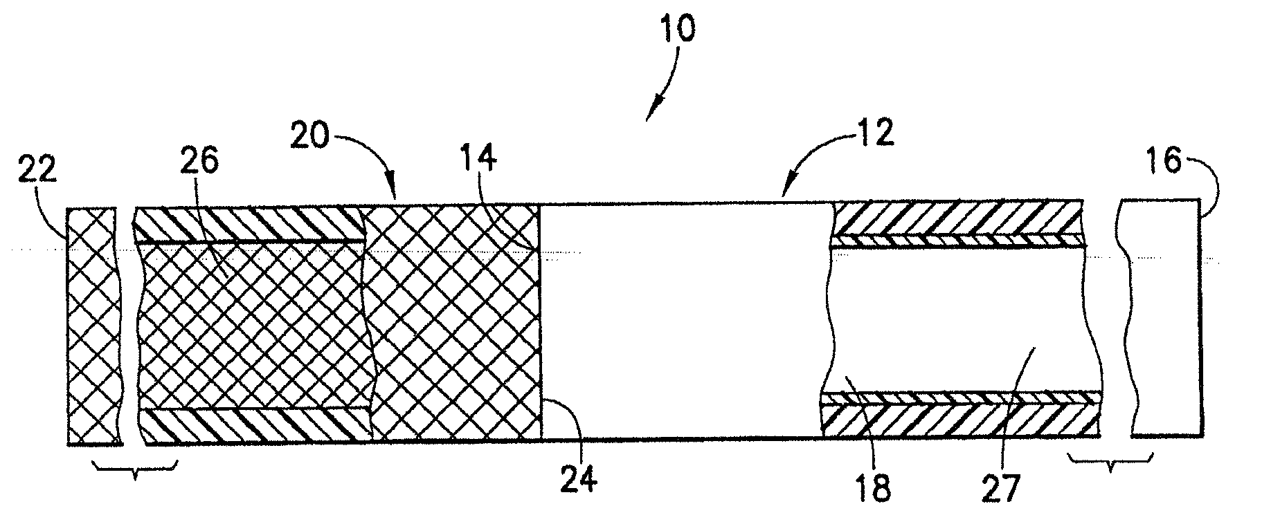 Stent/graft assembly