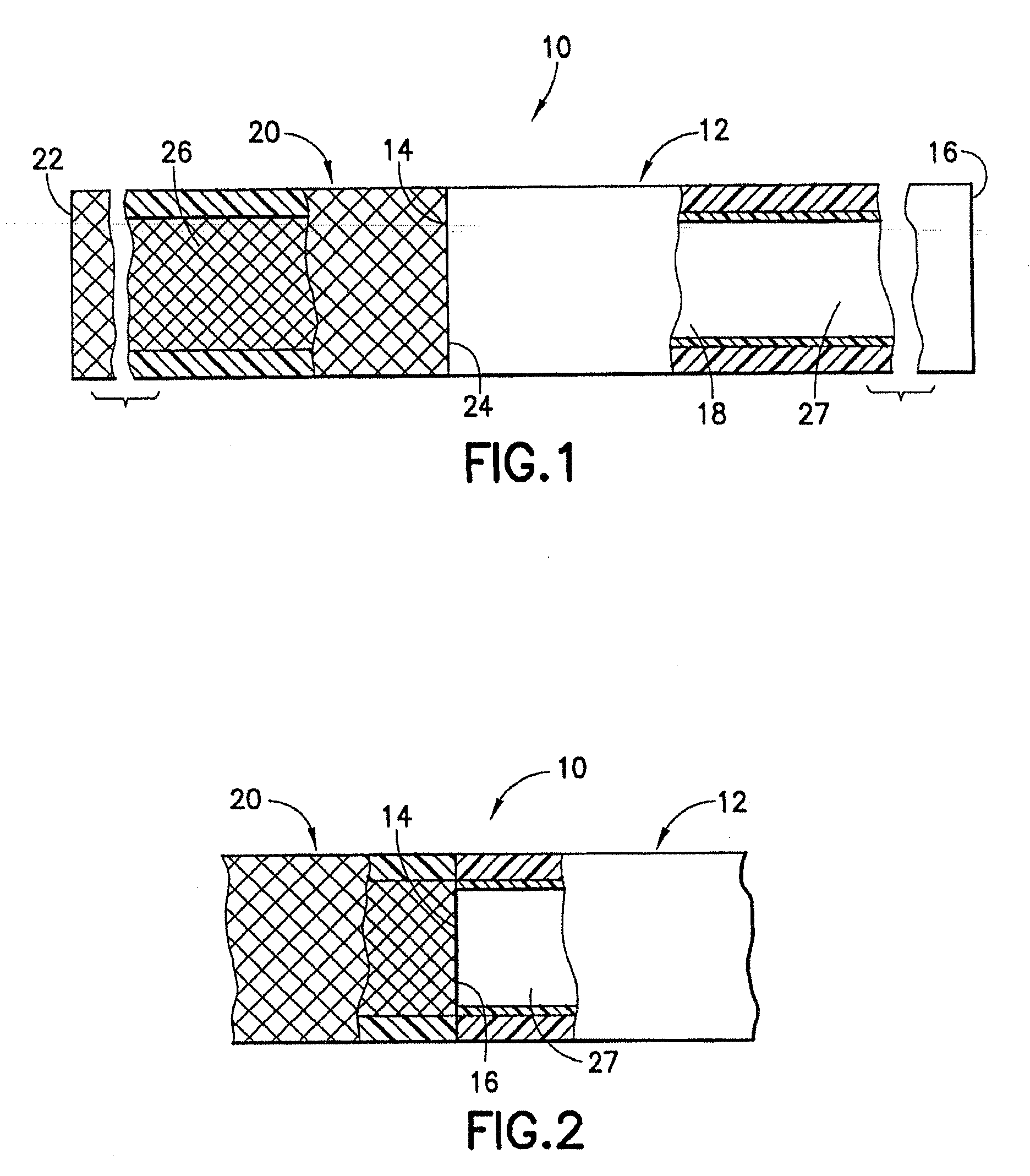 Stent/graft assembly