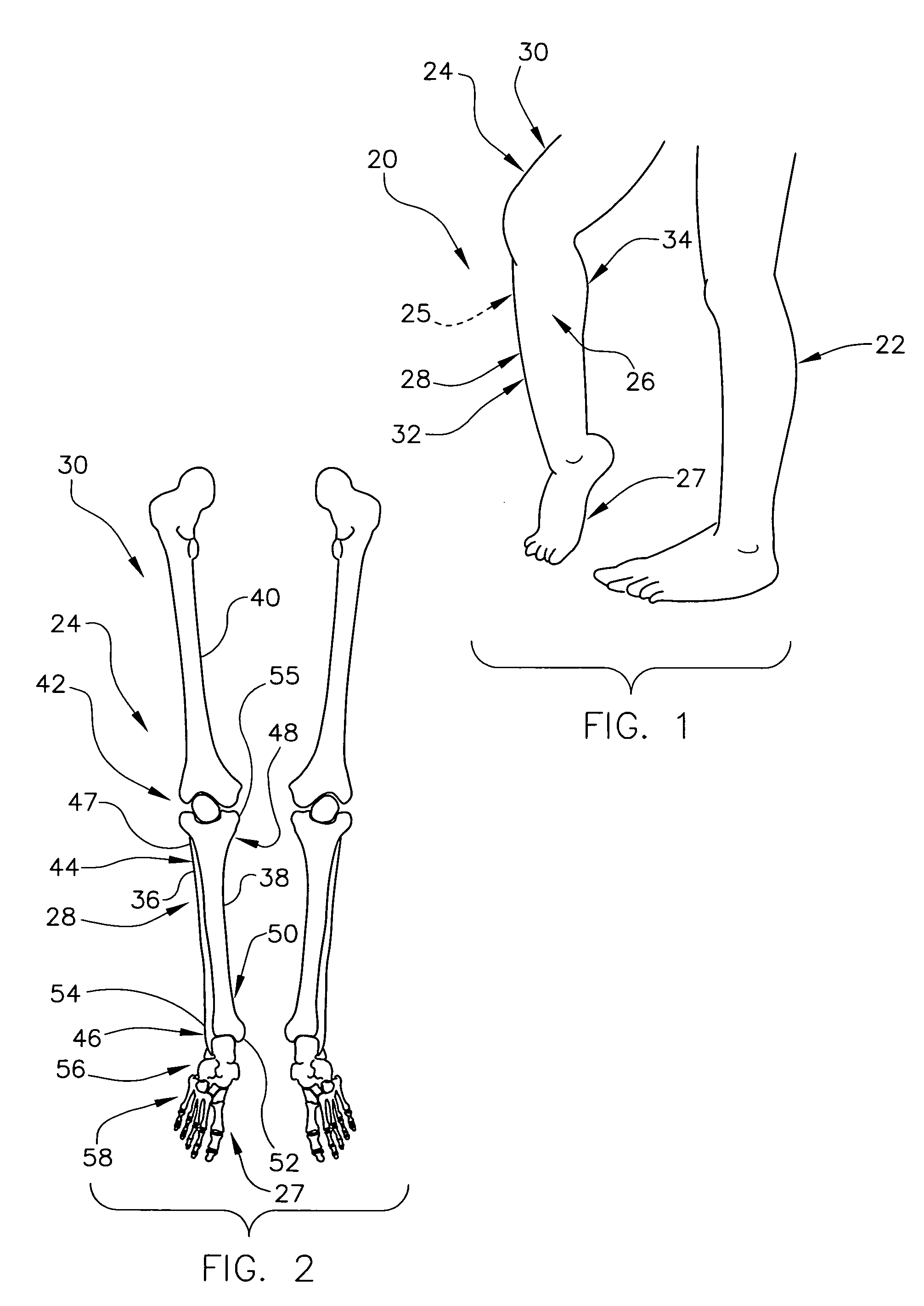 Method and apparatus for determining a dorsiflexion angle