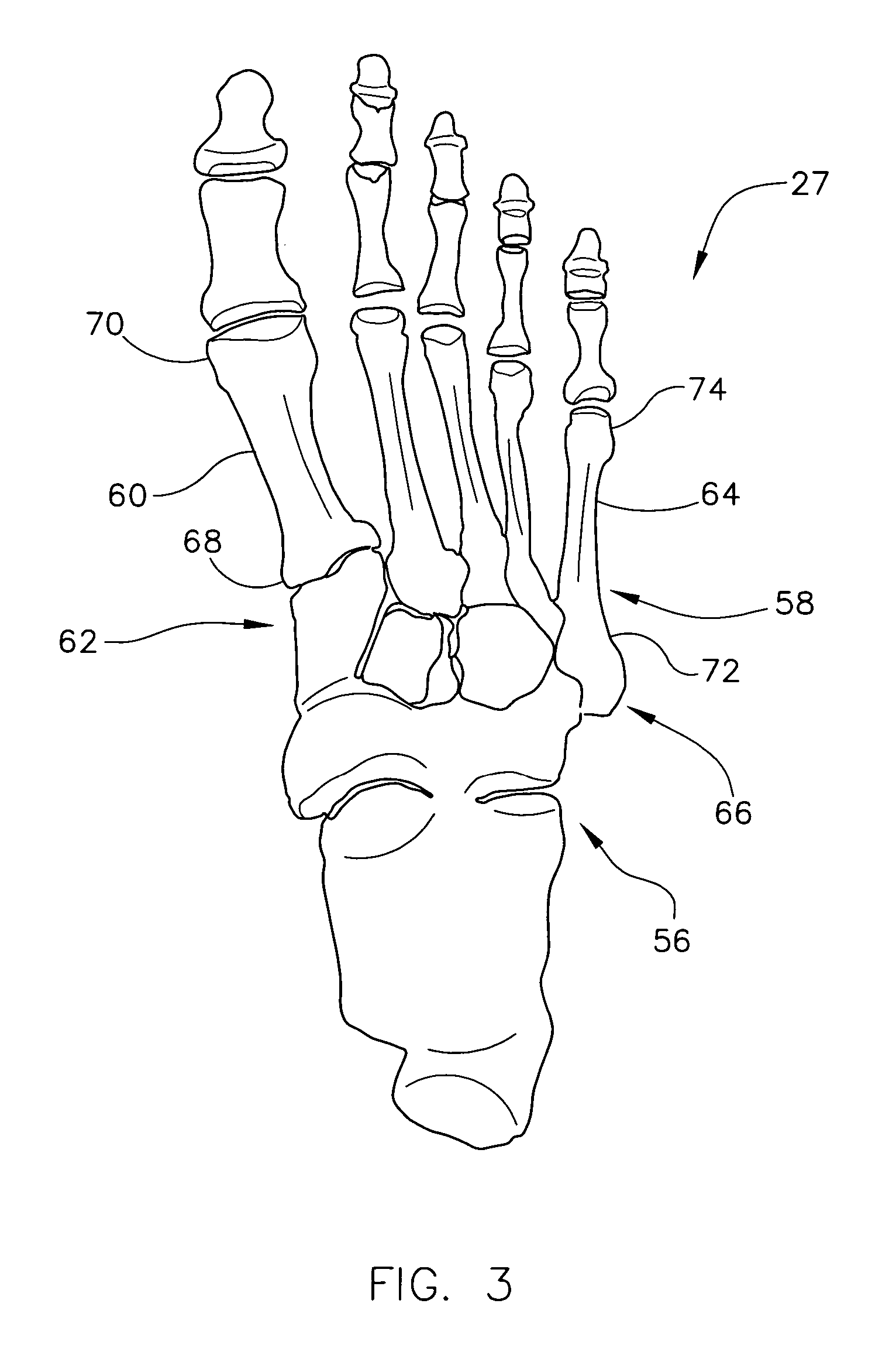 Method and apparatus for determining a dorsiflexion angle