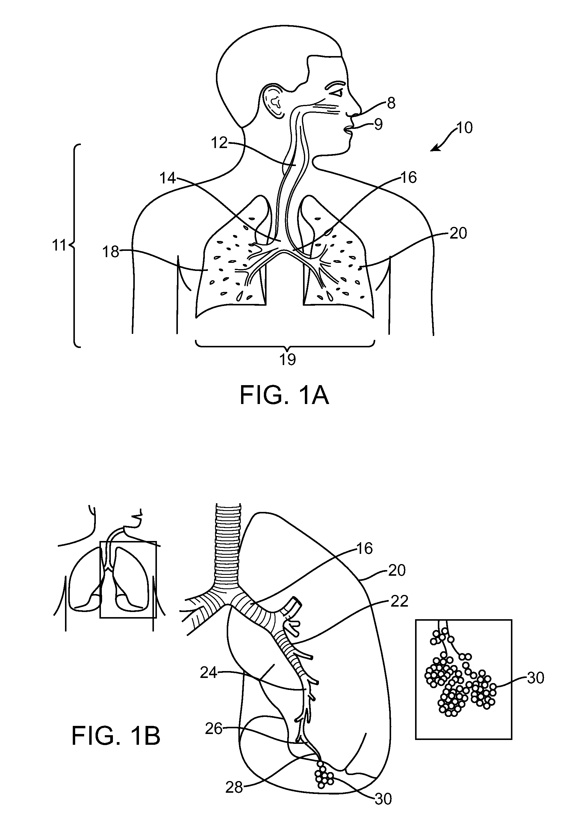 Lung Volume Reduction Devices, Methods, and Systems