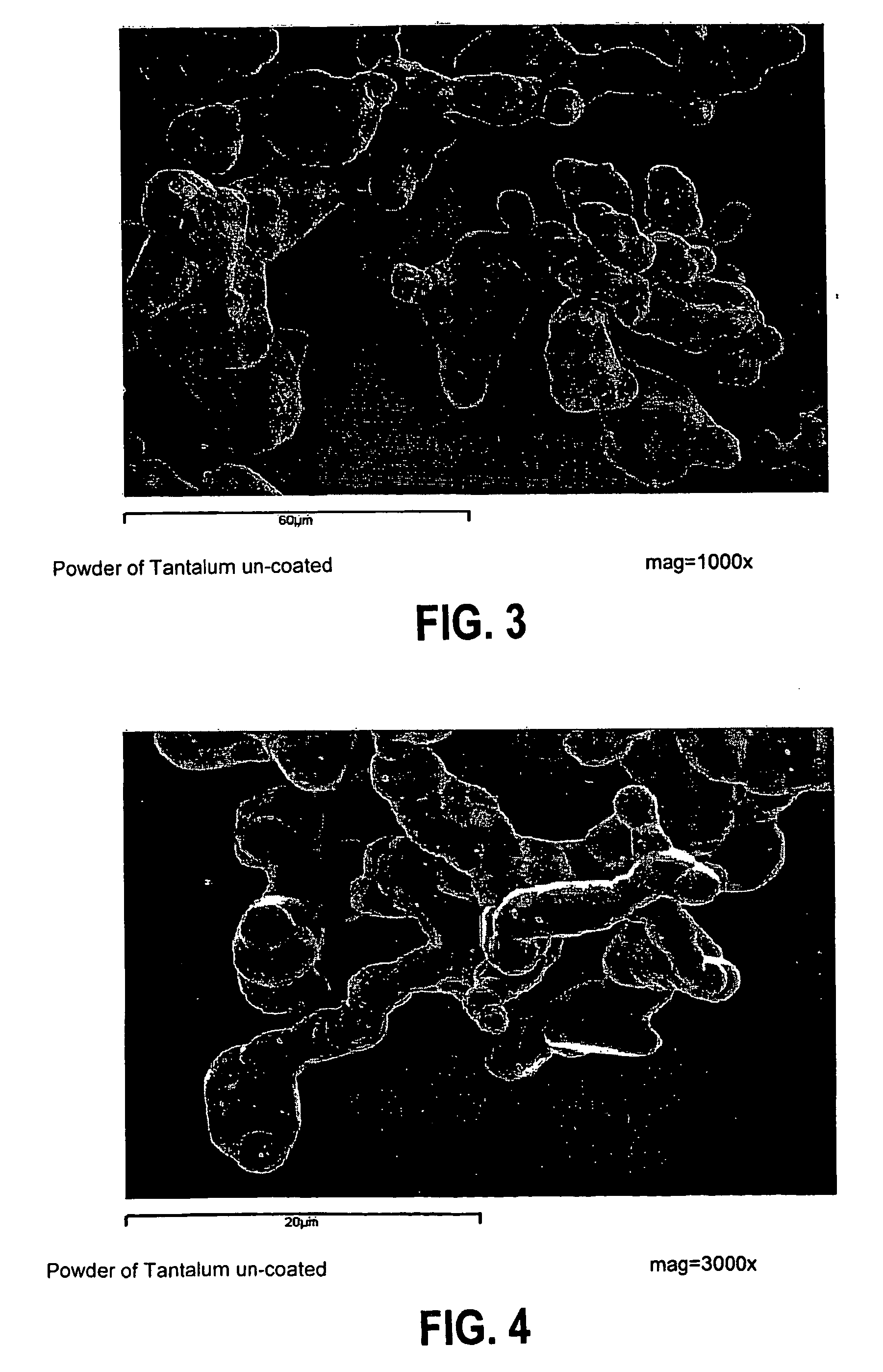 Bone cement containing coated radiopaque particles and its preparation